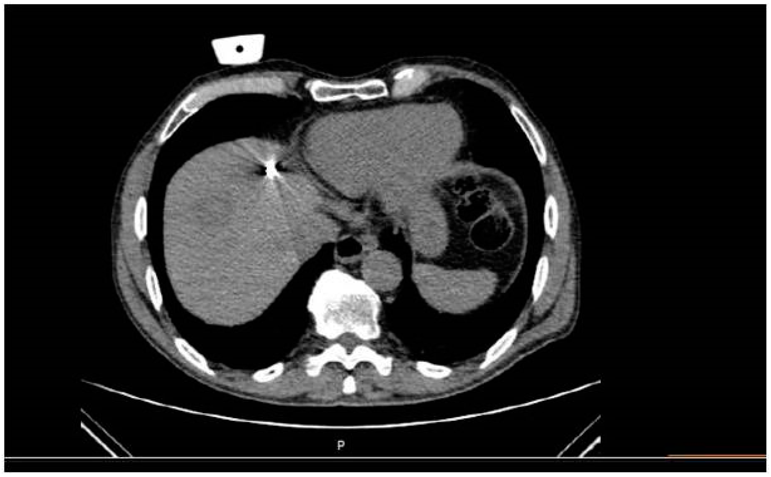 Medicina 57 01056 g003 550