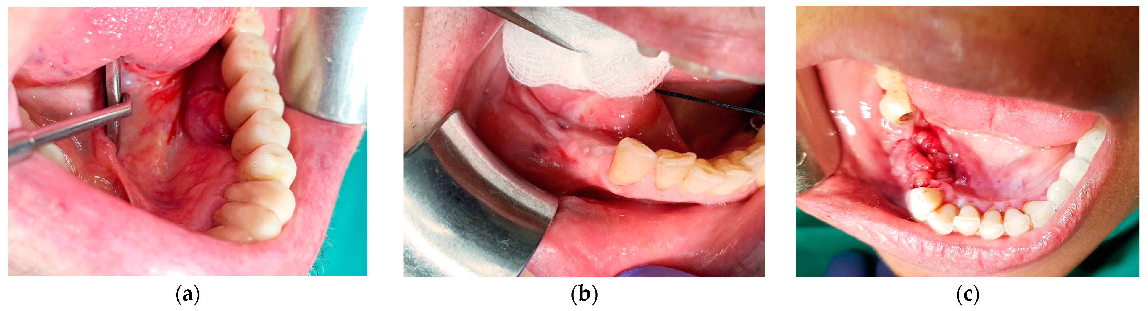 Medicina 57 01069 g001 550