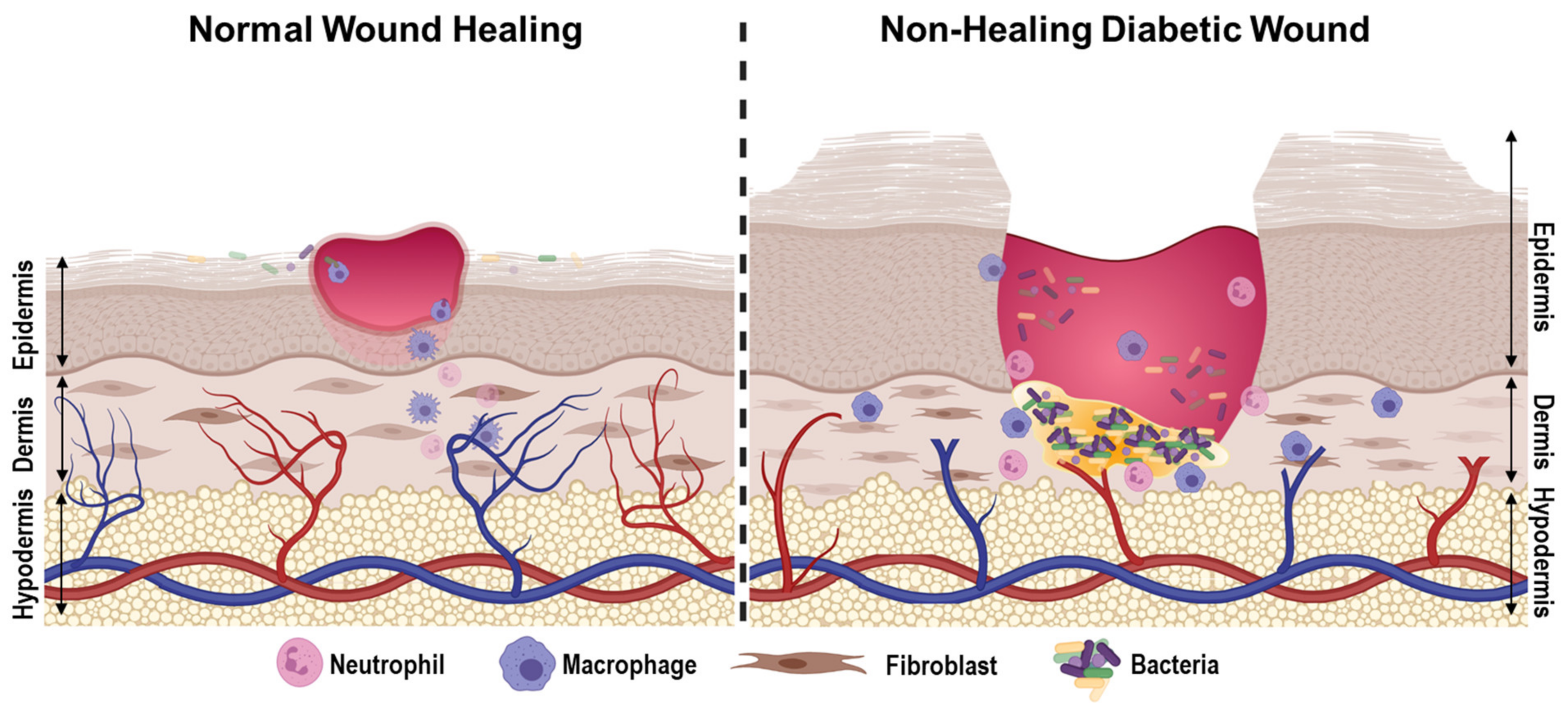 Medicina | Free Full-Text | Diabetic Wound-Healing Science