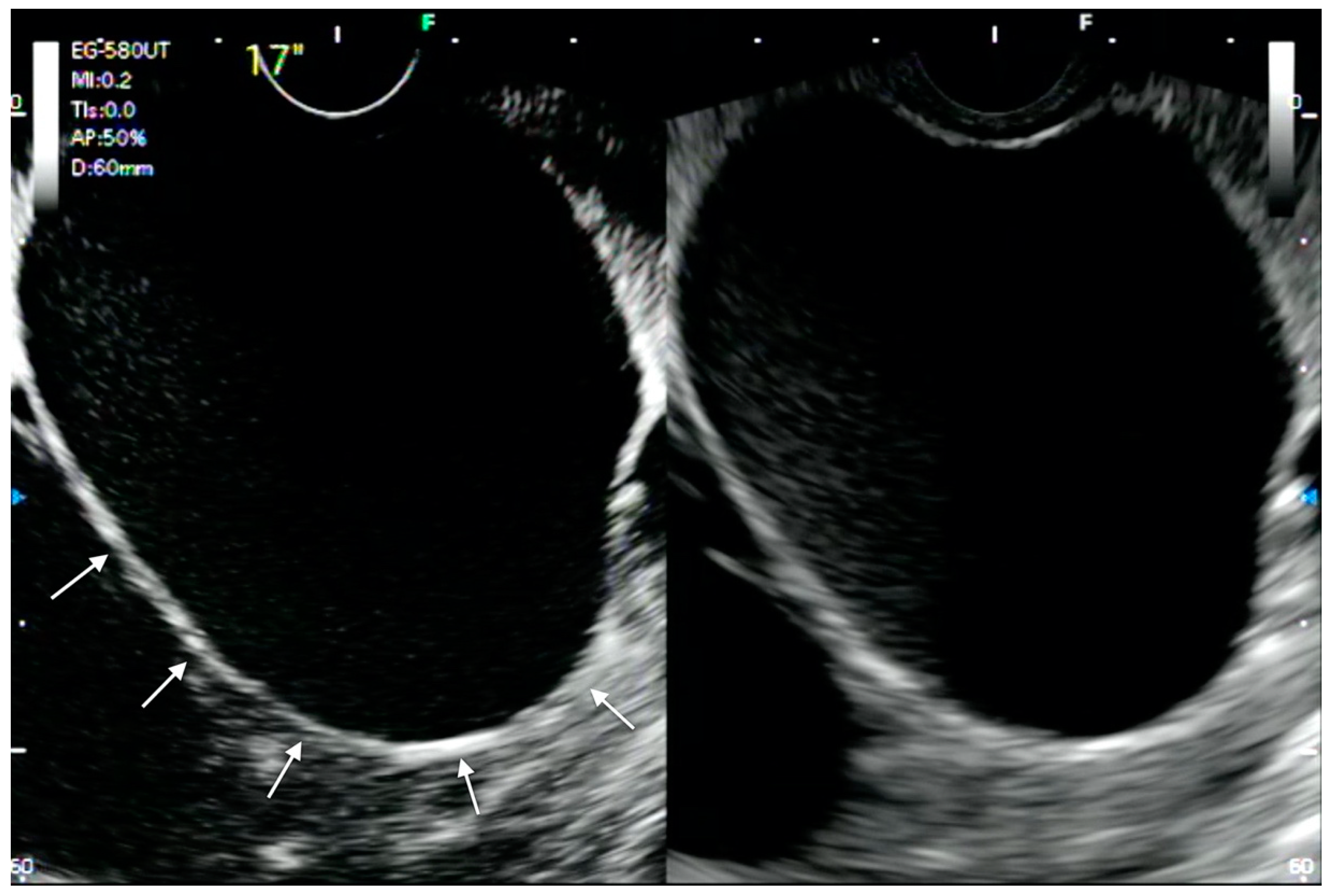 Medicina 57 01085 g002 Medicina 57 01085 g002