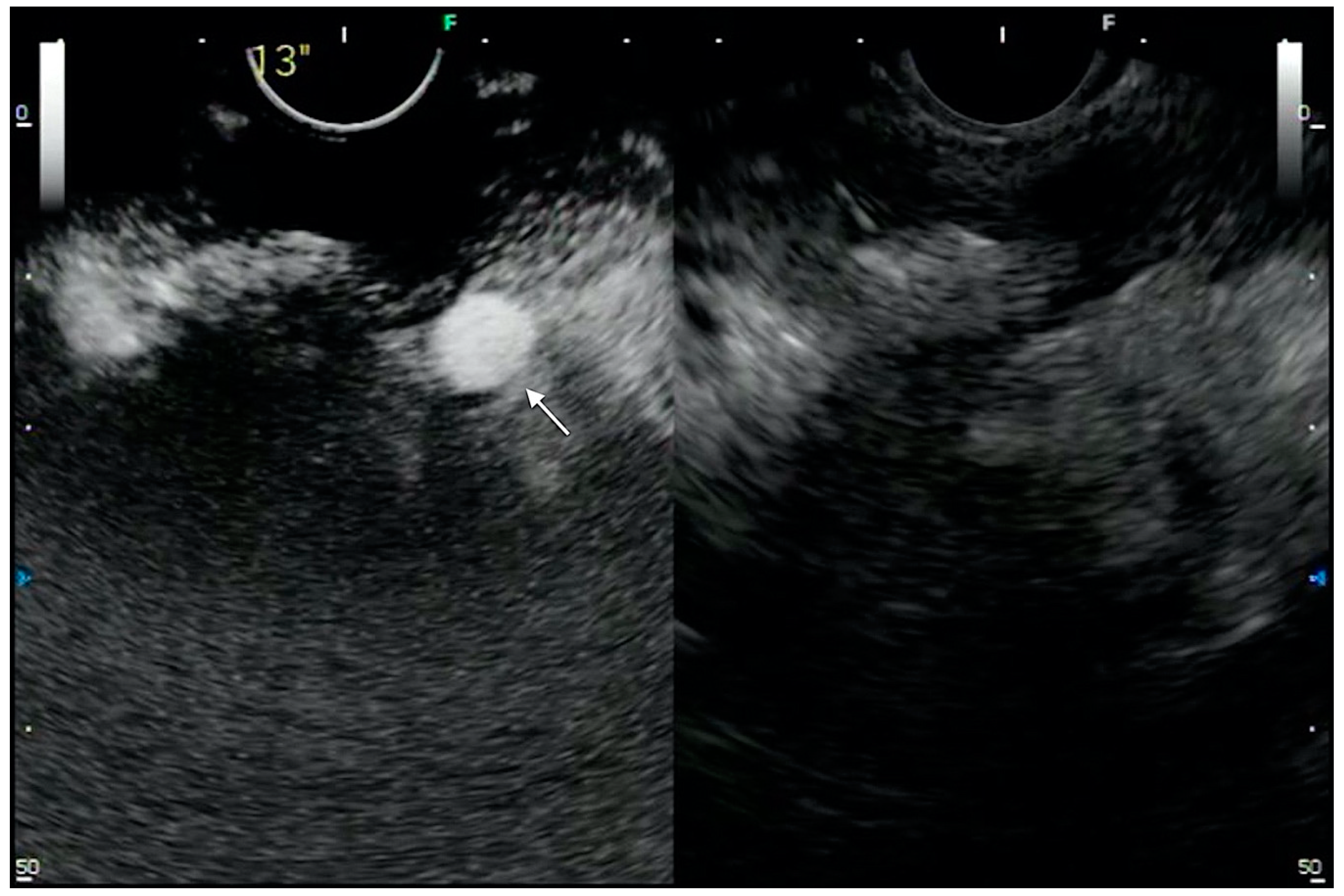 Medicina 57 01085 g003 Medicina 57 01085 g003