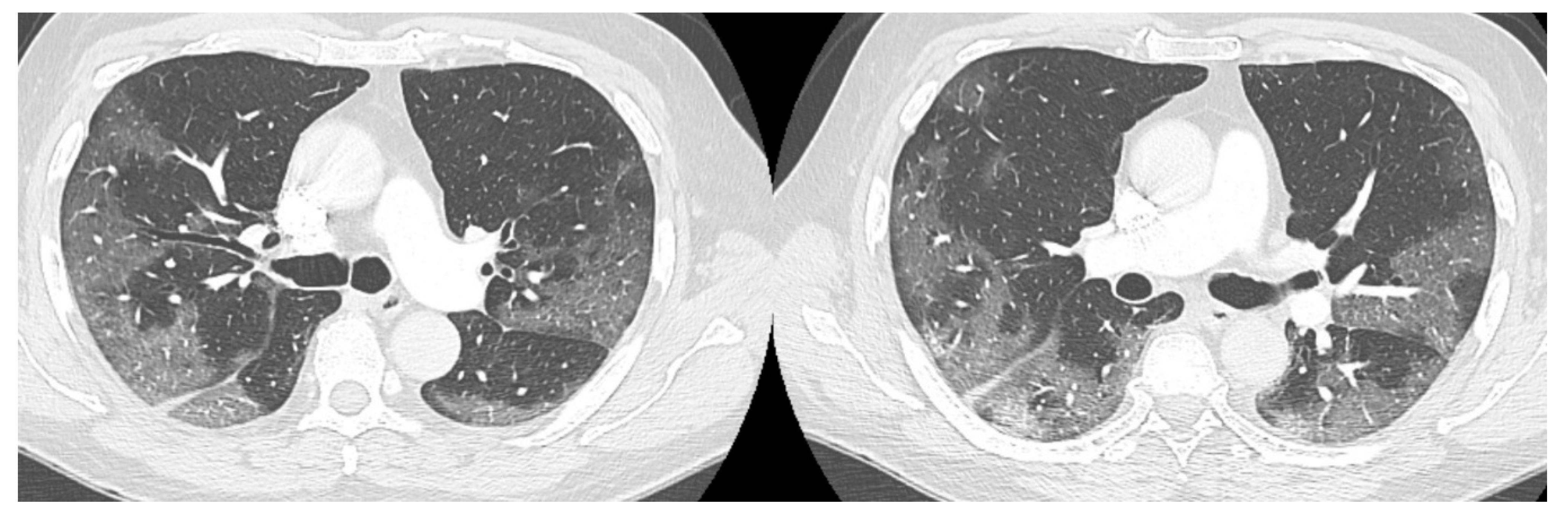Medicina 57 01122 g001 550