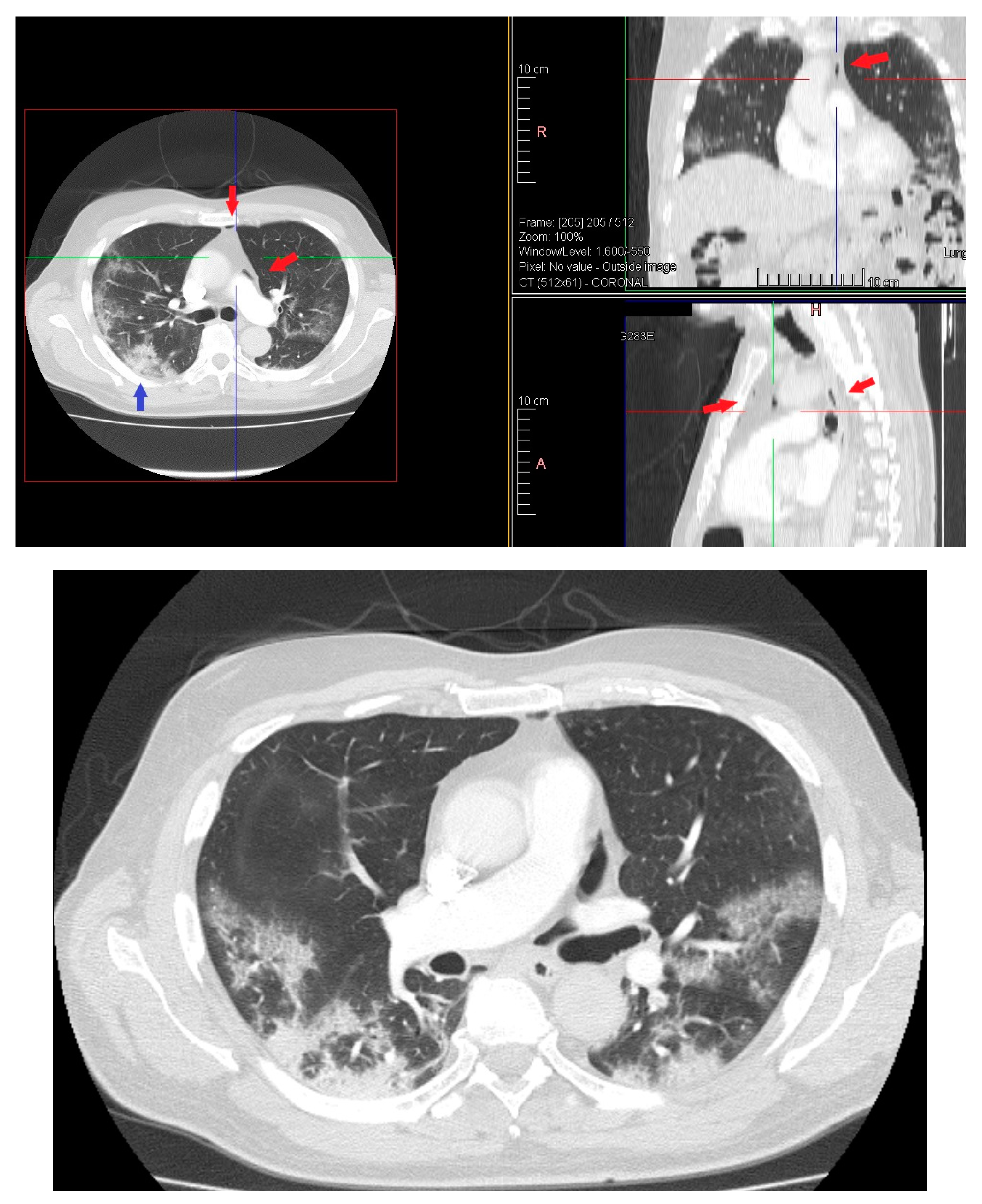 Medicina 57 01122 g003 550