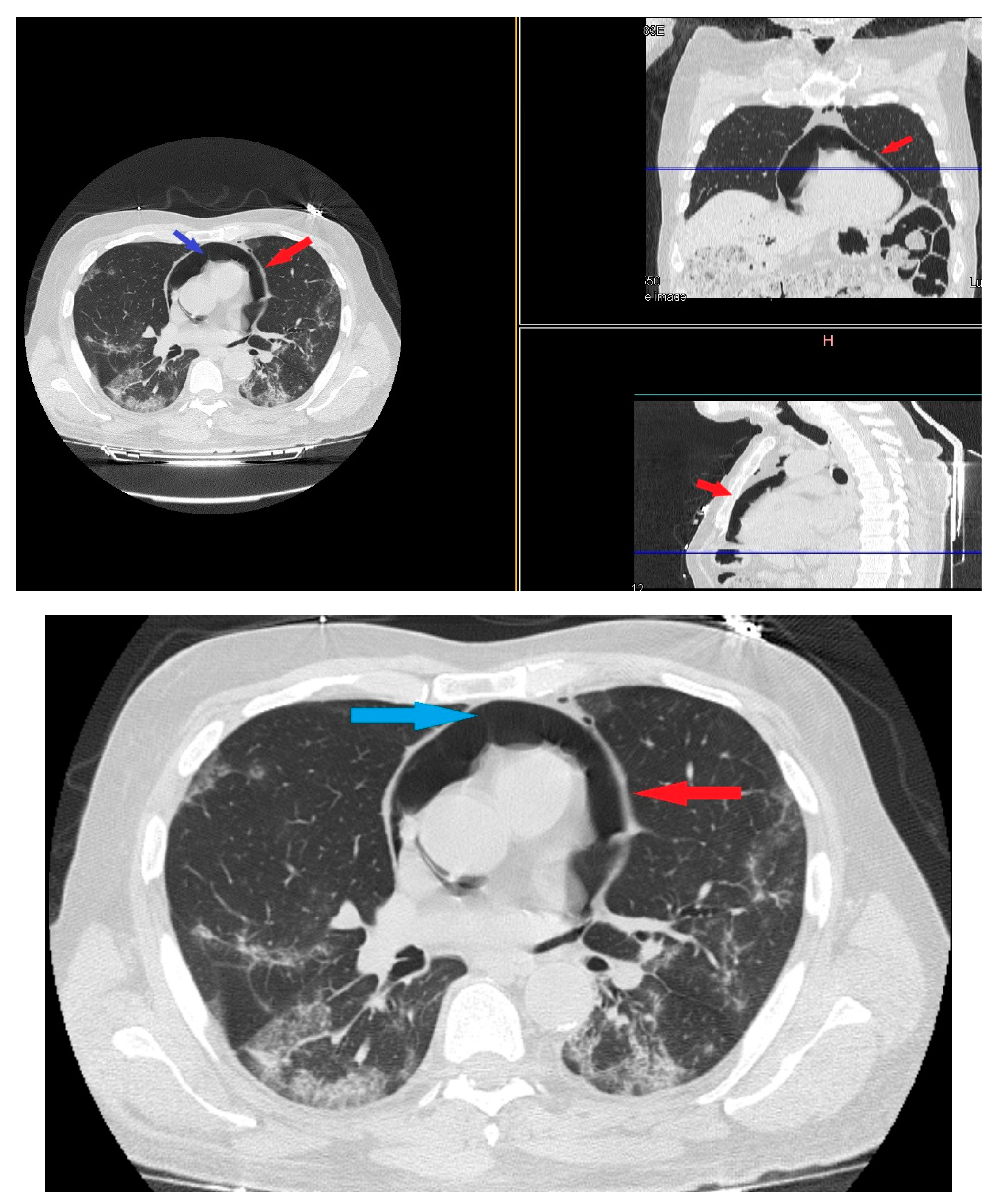 Medicina 57 01122 g004 550
