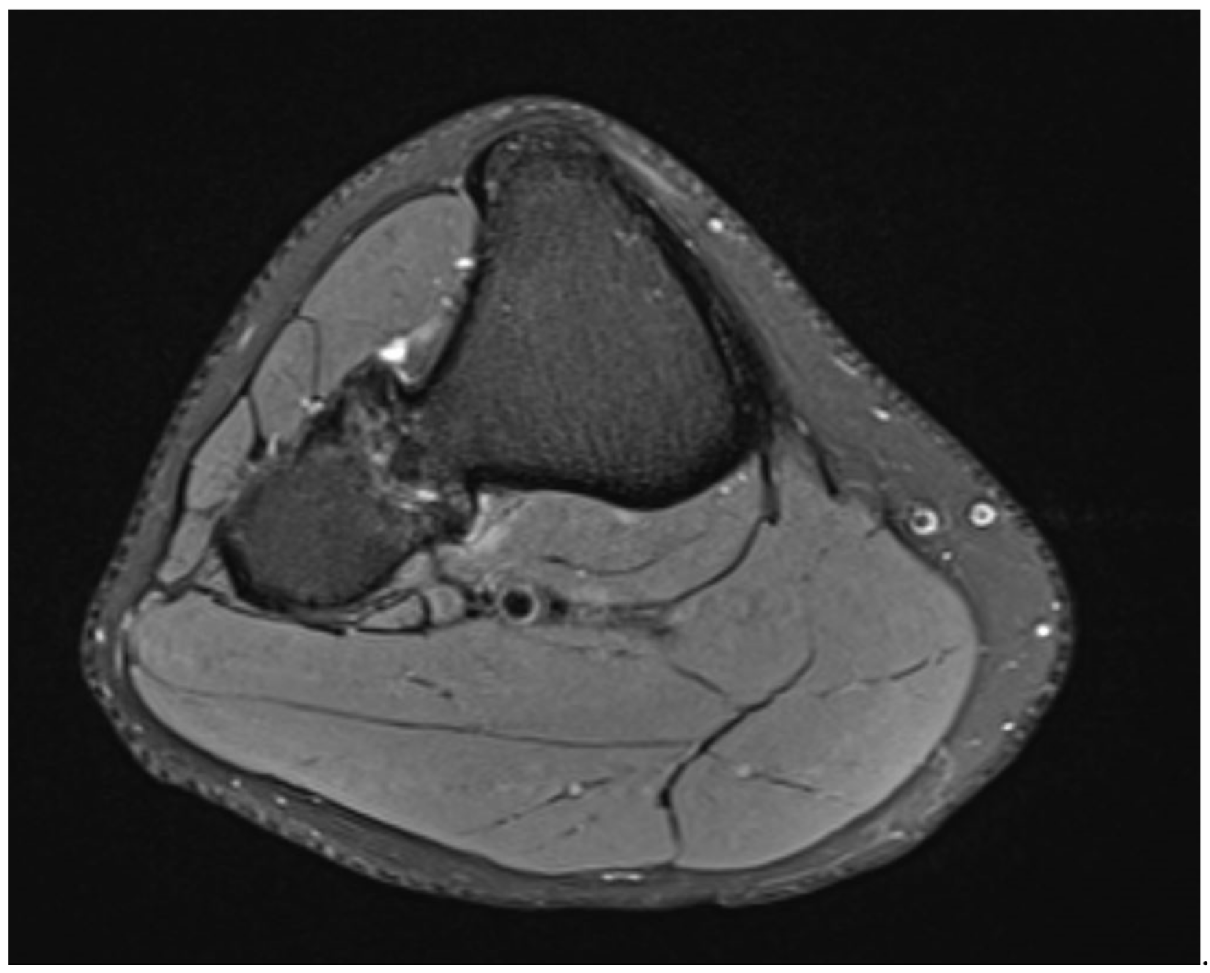 Medicina 57 01126 g003