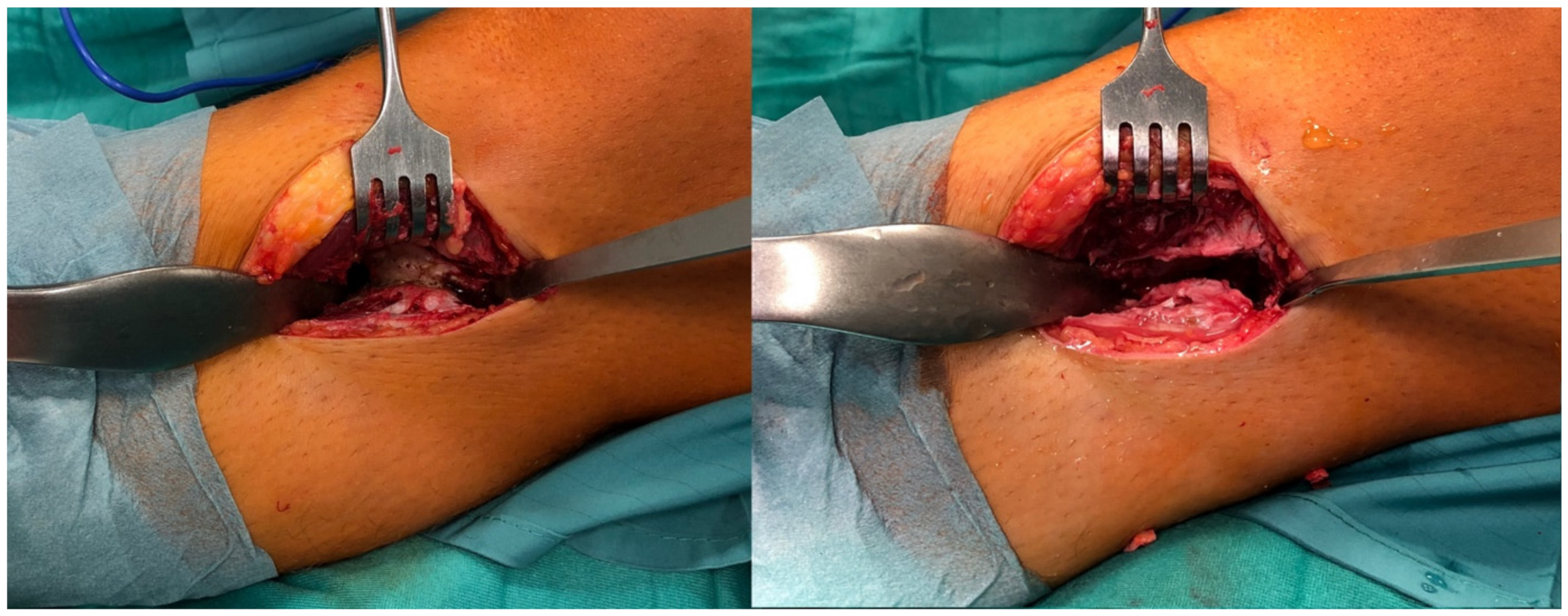 Medicina 57 01126 g004