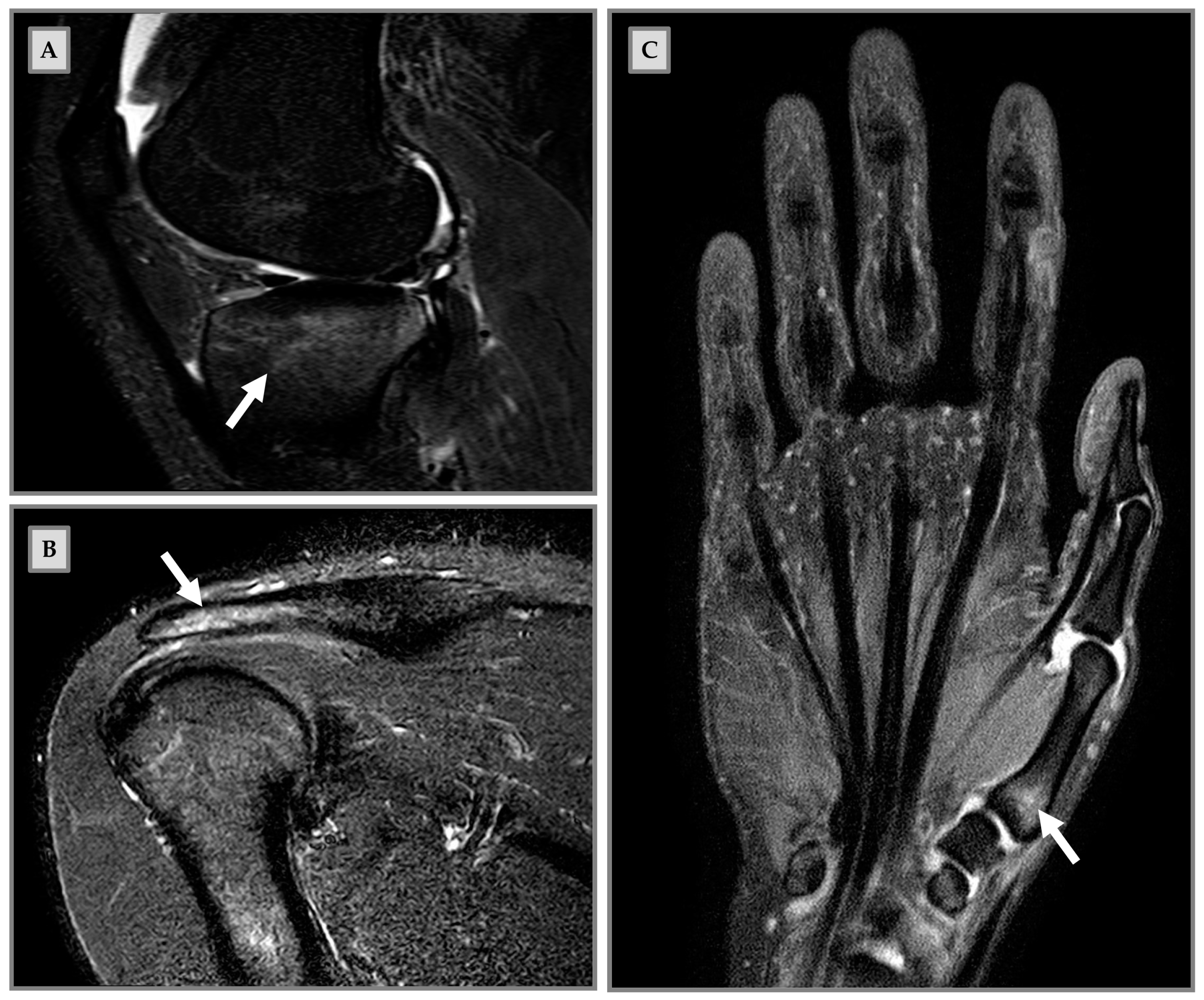 Medicina 57 01143 g001