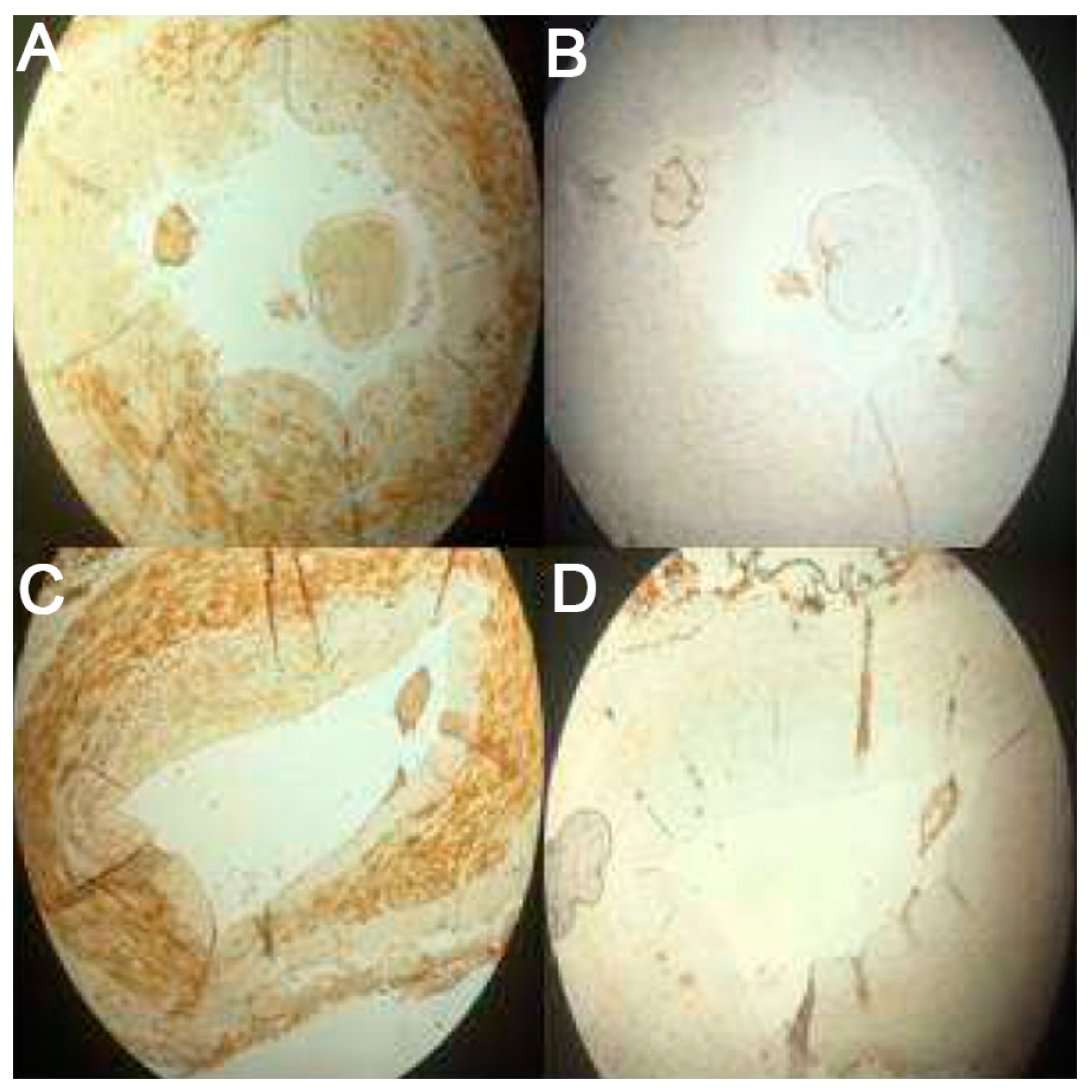 Medicina 57 01156 g001 Medicina 57 01156 g001