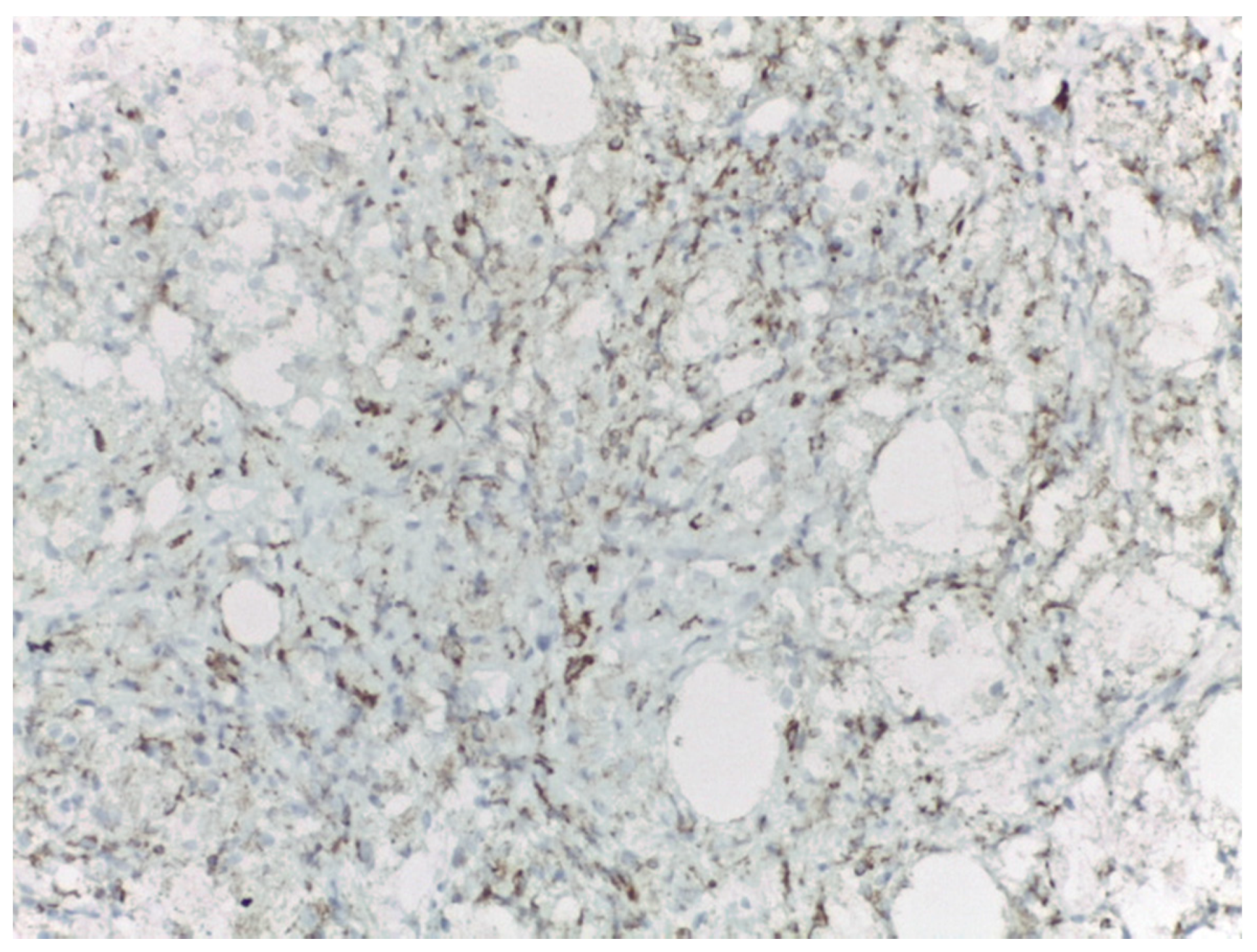 Medicina 57 01167 g005