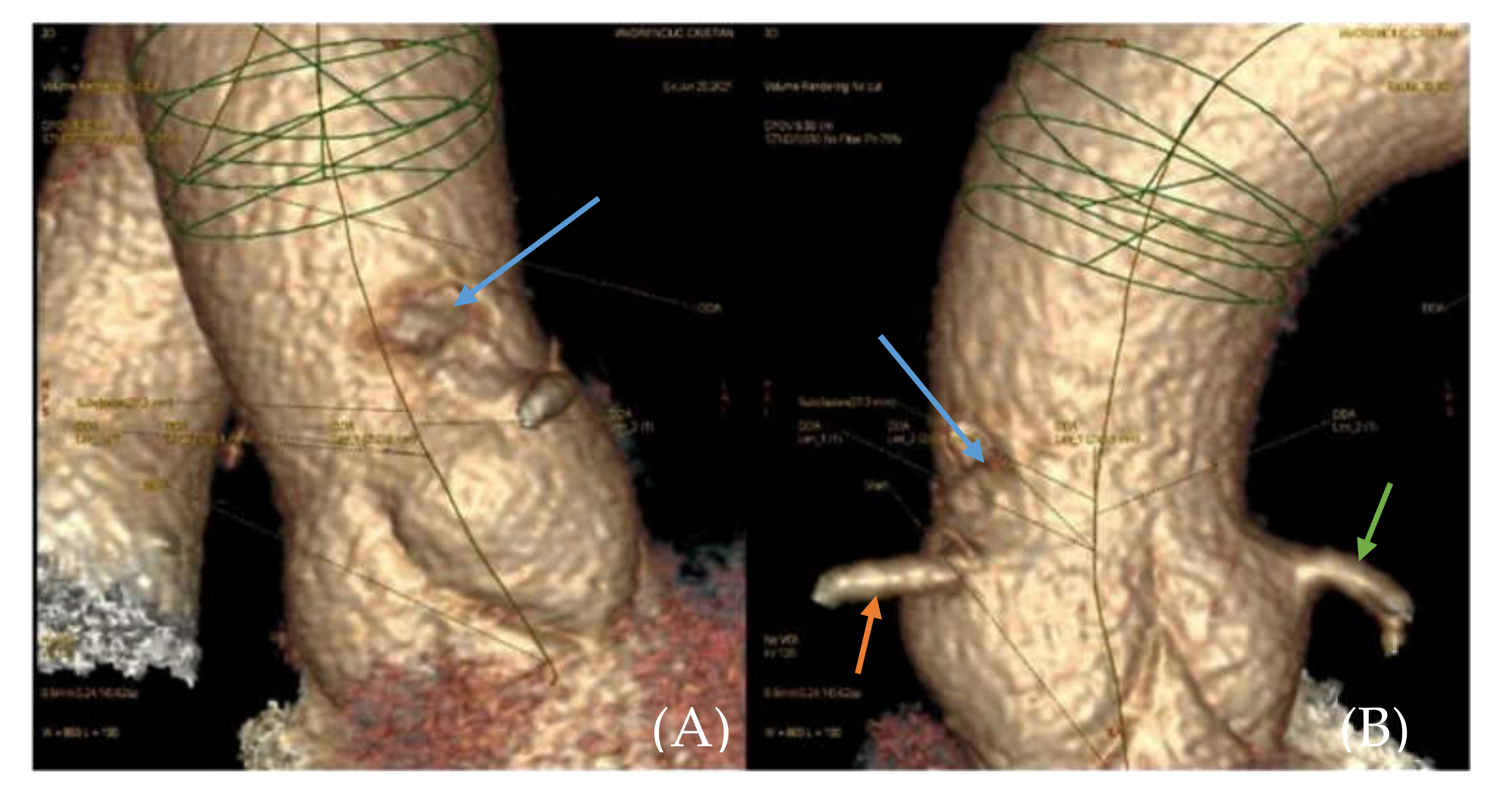 Medicina 57 01176 g002