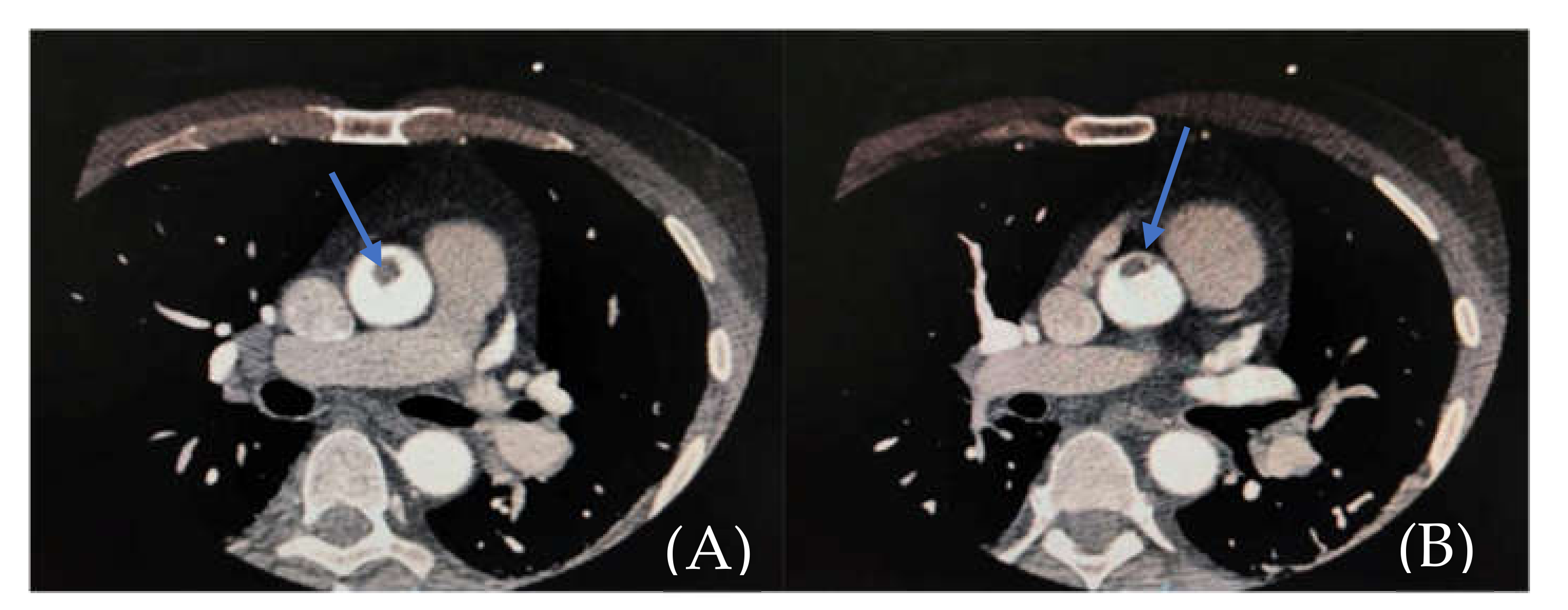 Medicina 57 01176 g003