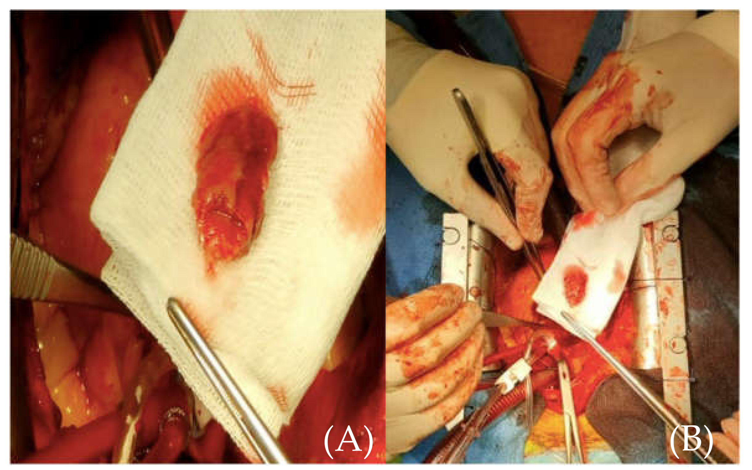 Medicina 57 01176 g006