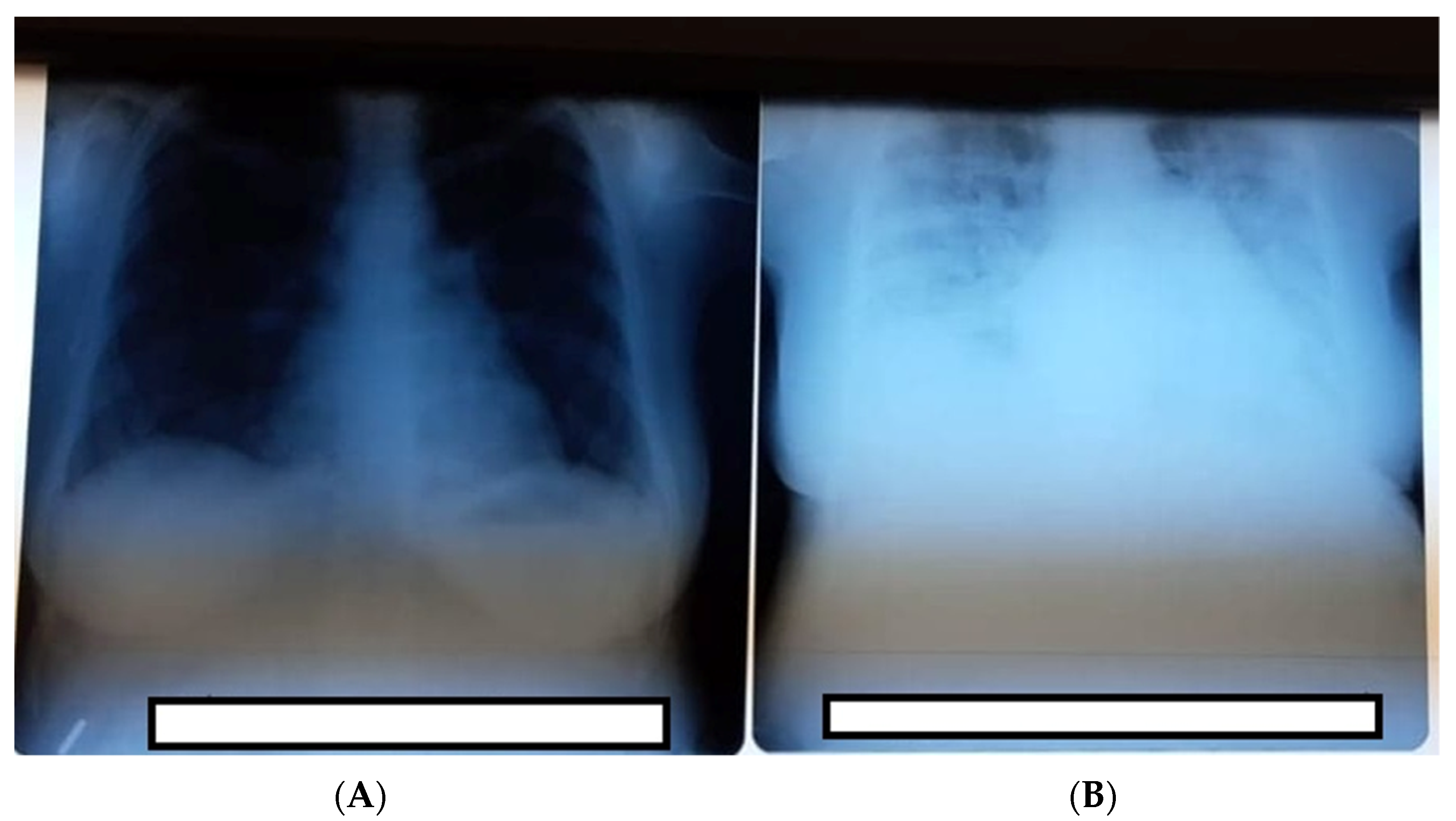 Medicina 57 01186 g001 550