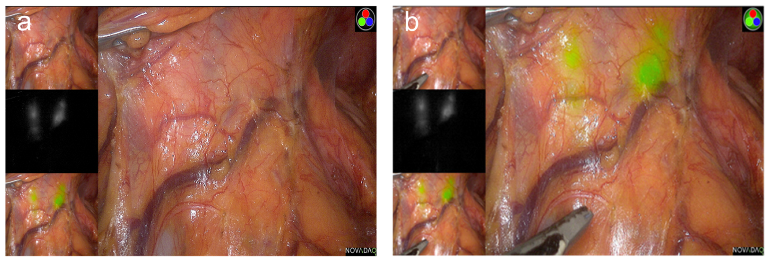 Medicina 57 01195 g003 Medicina 57 01195 g003