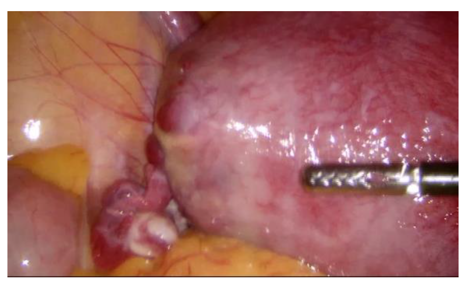 Medicina 57 01207 g003 550