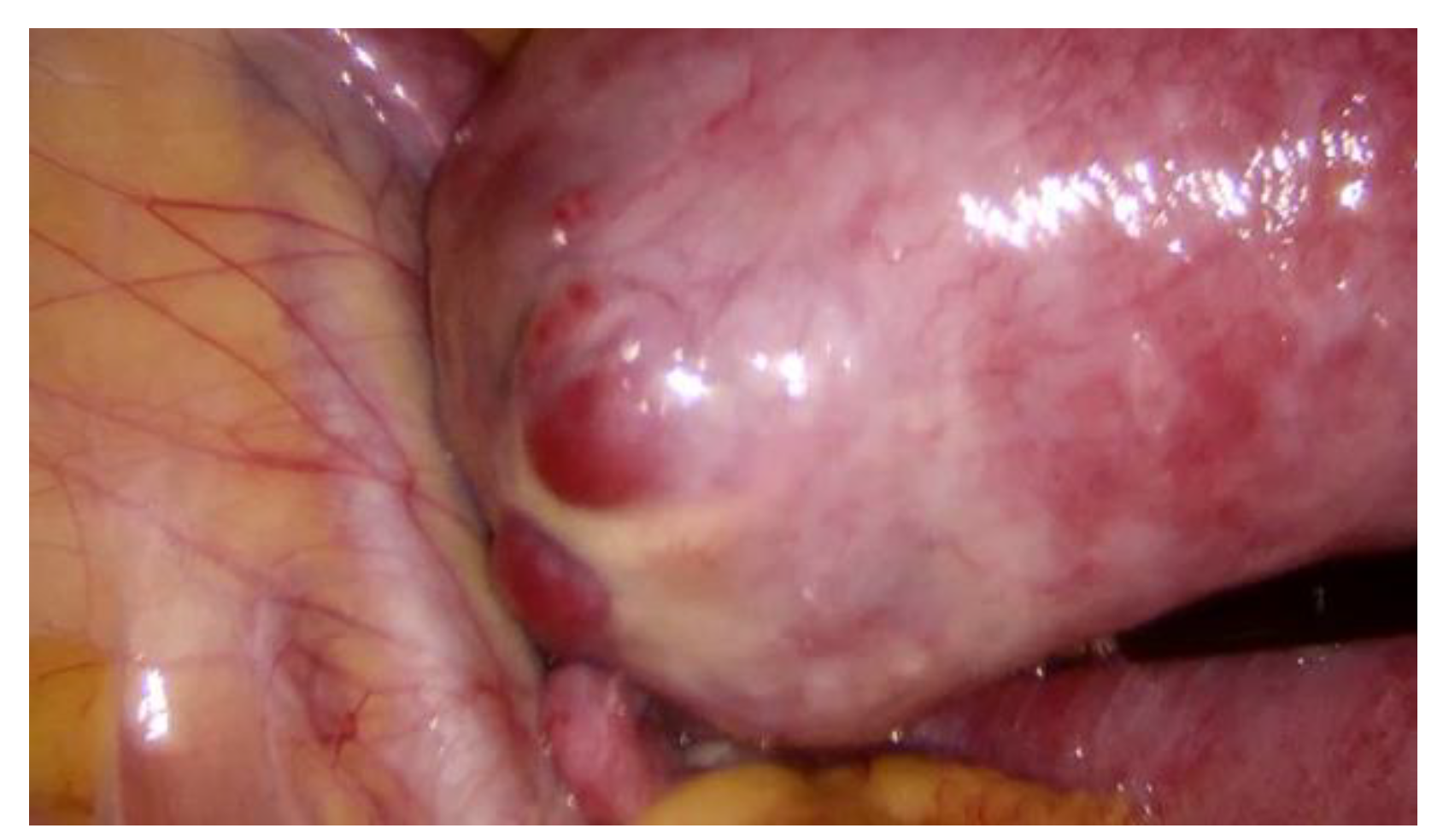 Medicina 57 01207 g004 550