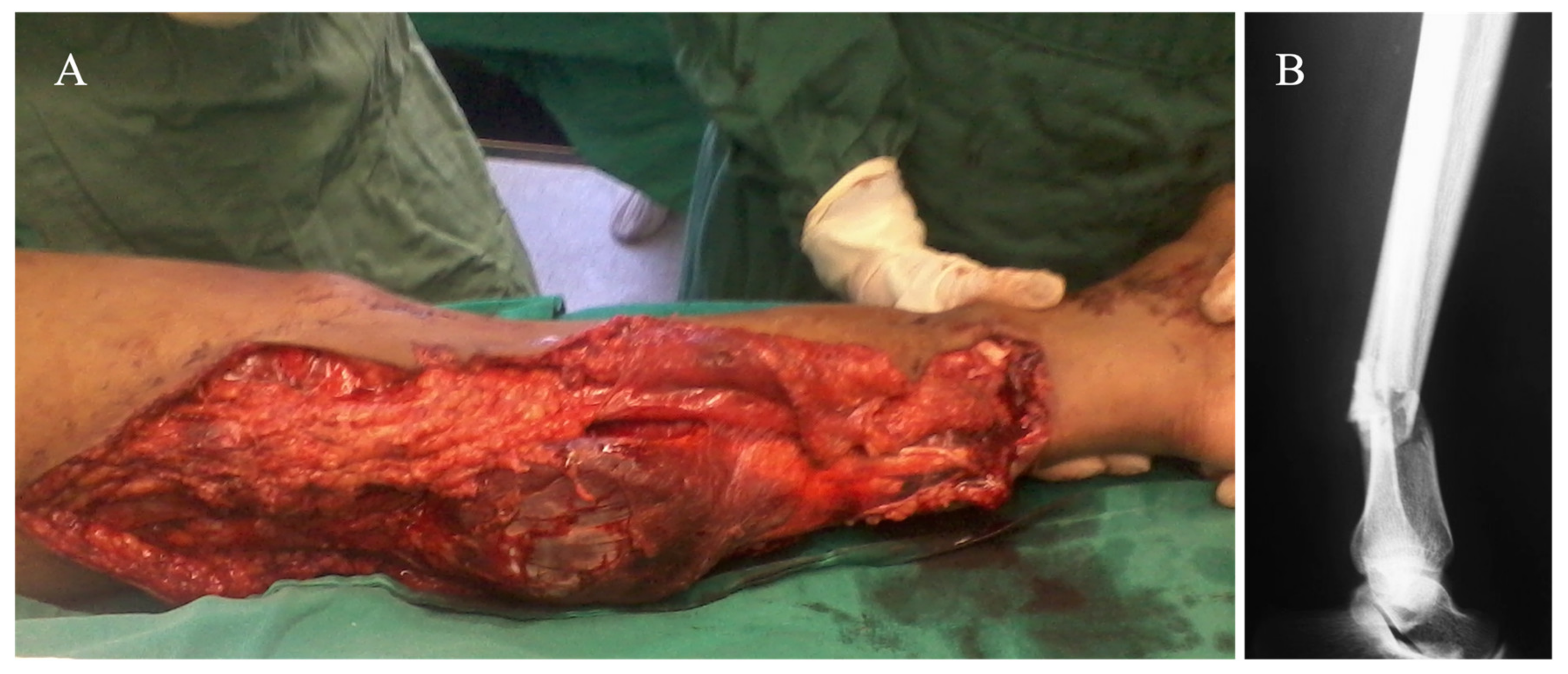 Medicina 57 01220 g001