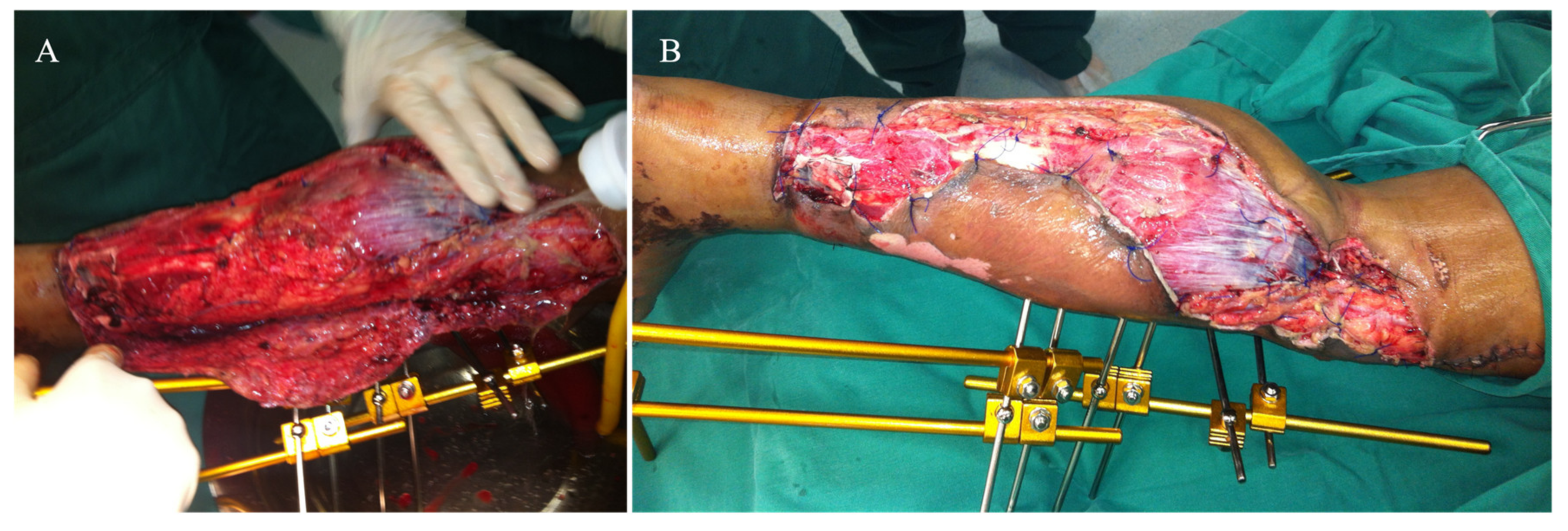 Medicina 57 01220 g002