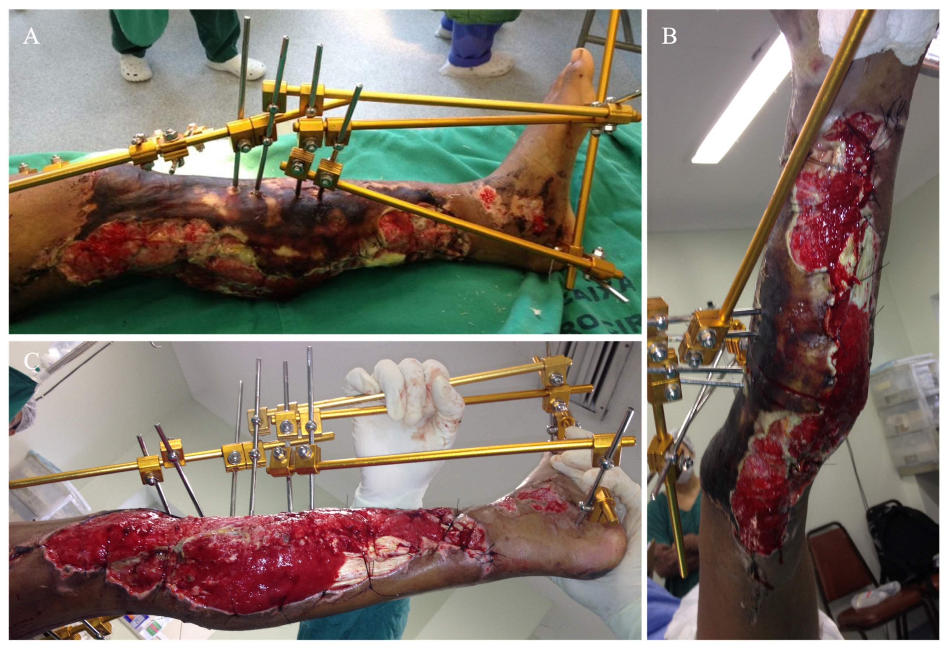 Medicina 57 01220 g003