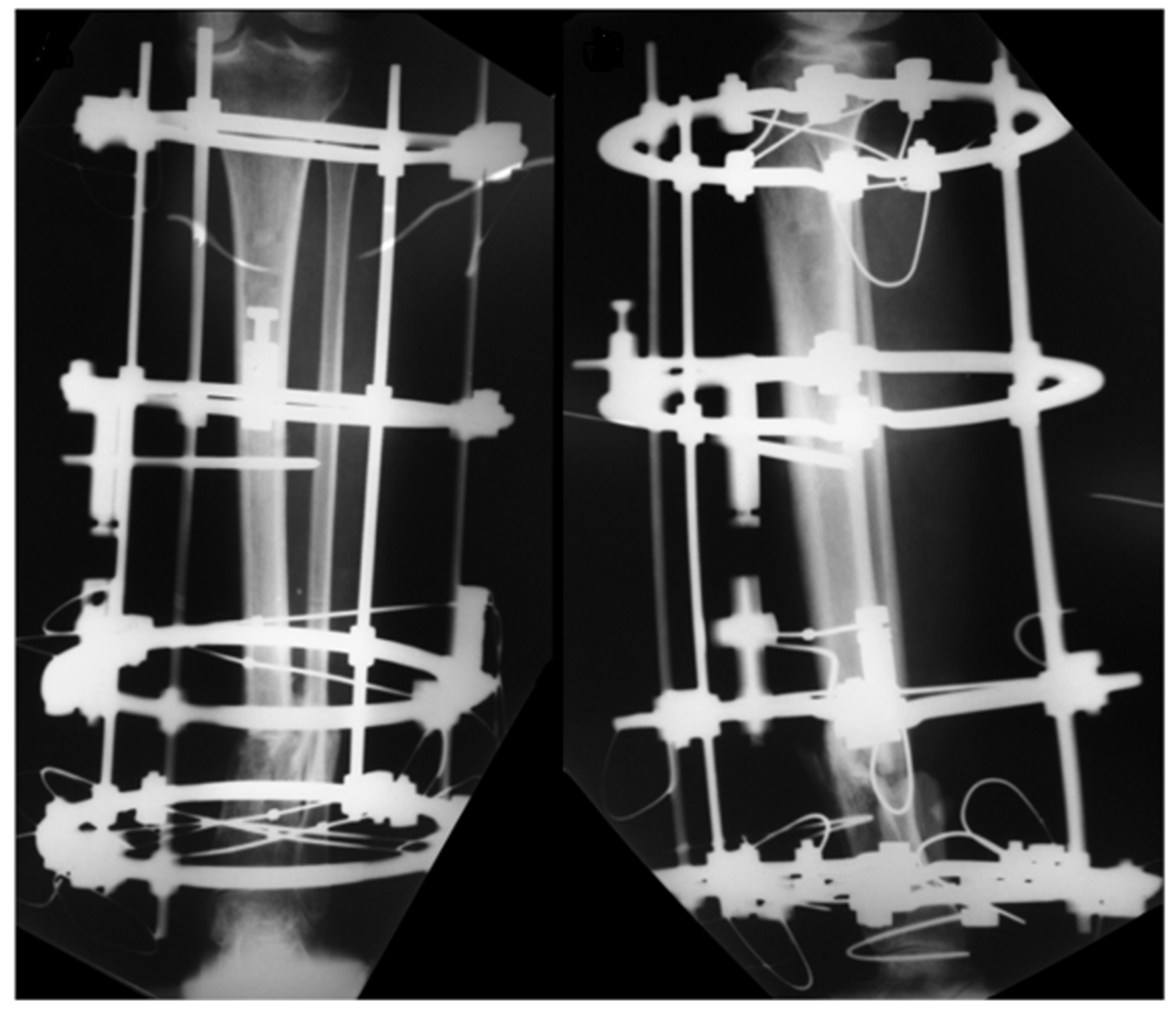 Medicina 57 01220 g006