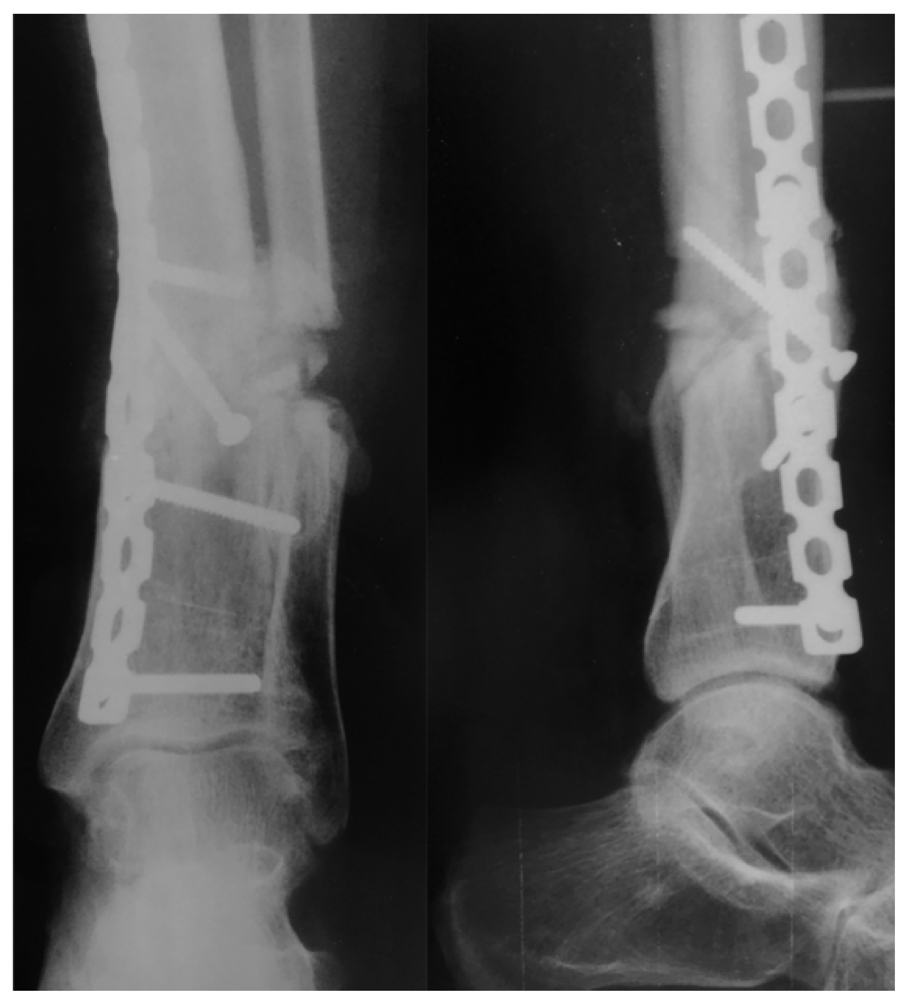 Medicina 57 01220 g008