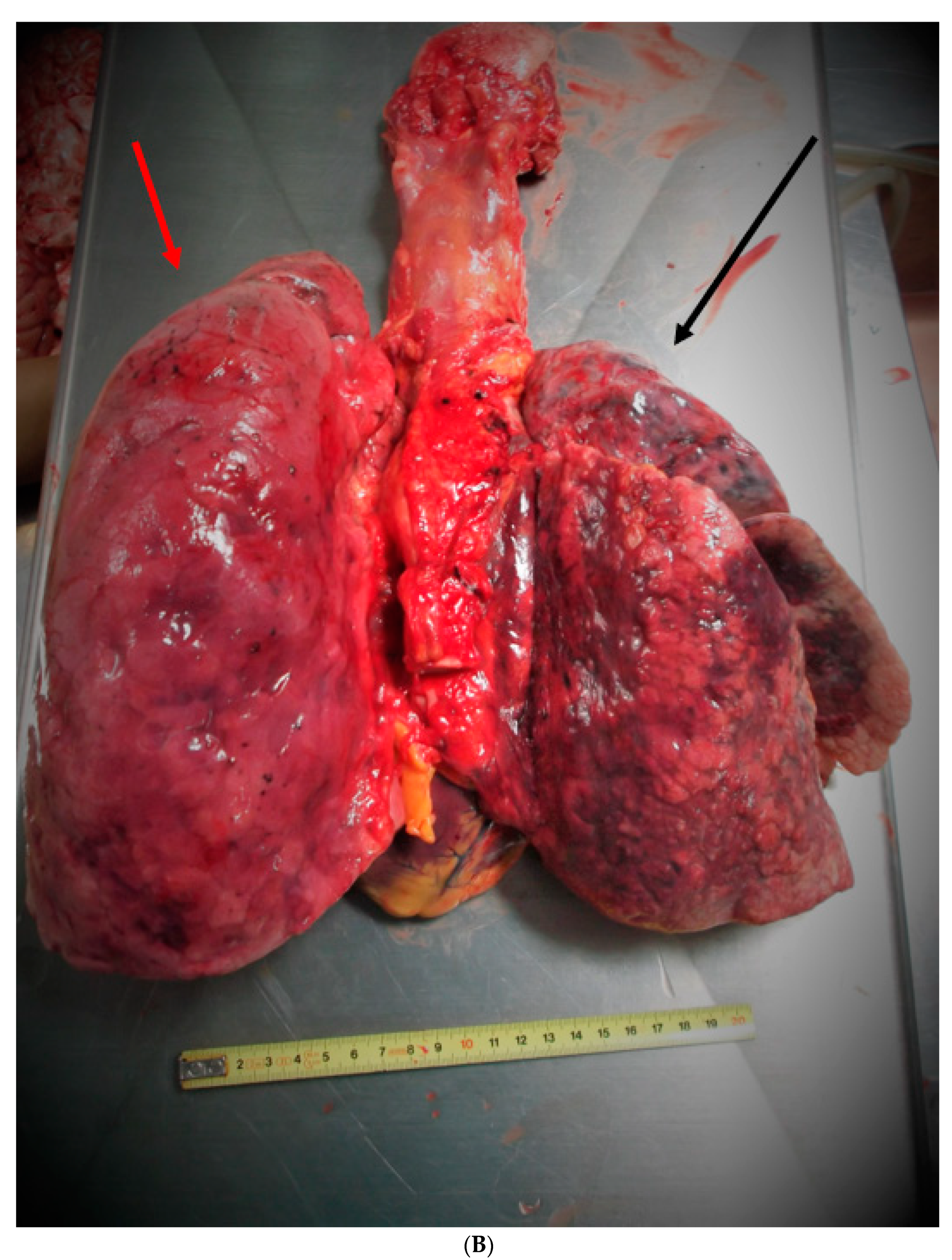 Medicina 57 01231 g001b 550