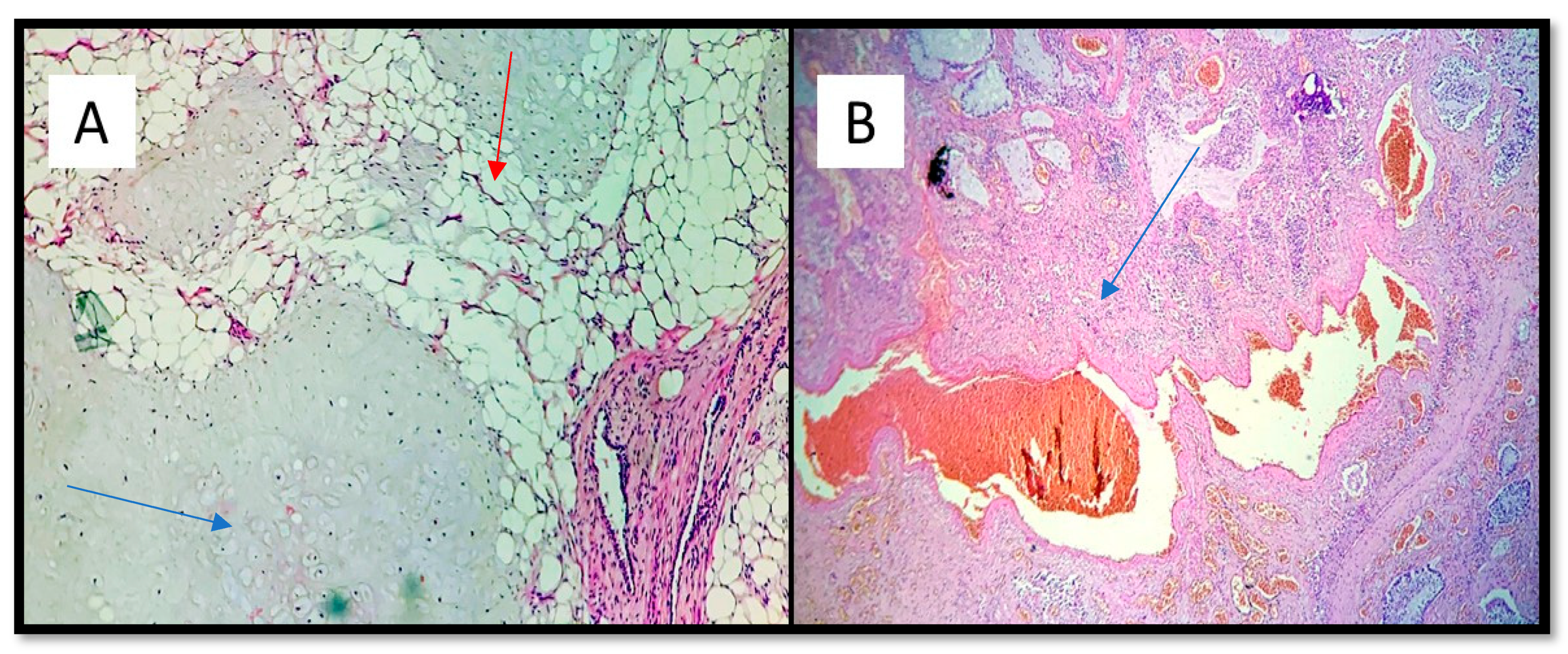 Medicina 57 01231 g004 550