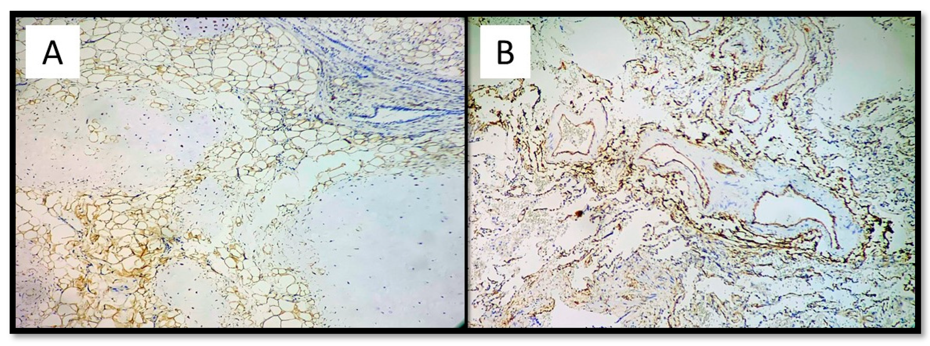 Medicina 57 01231 g005 550