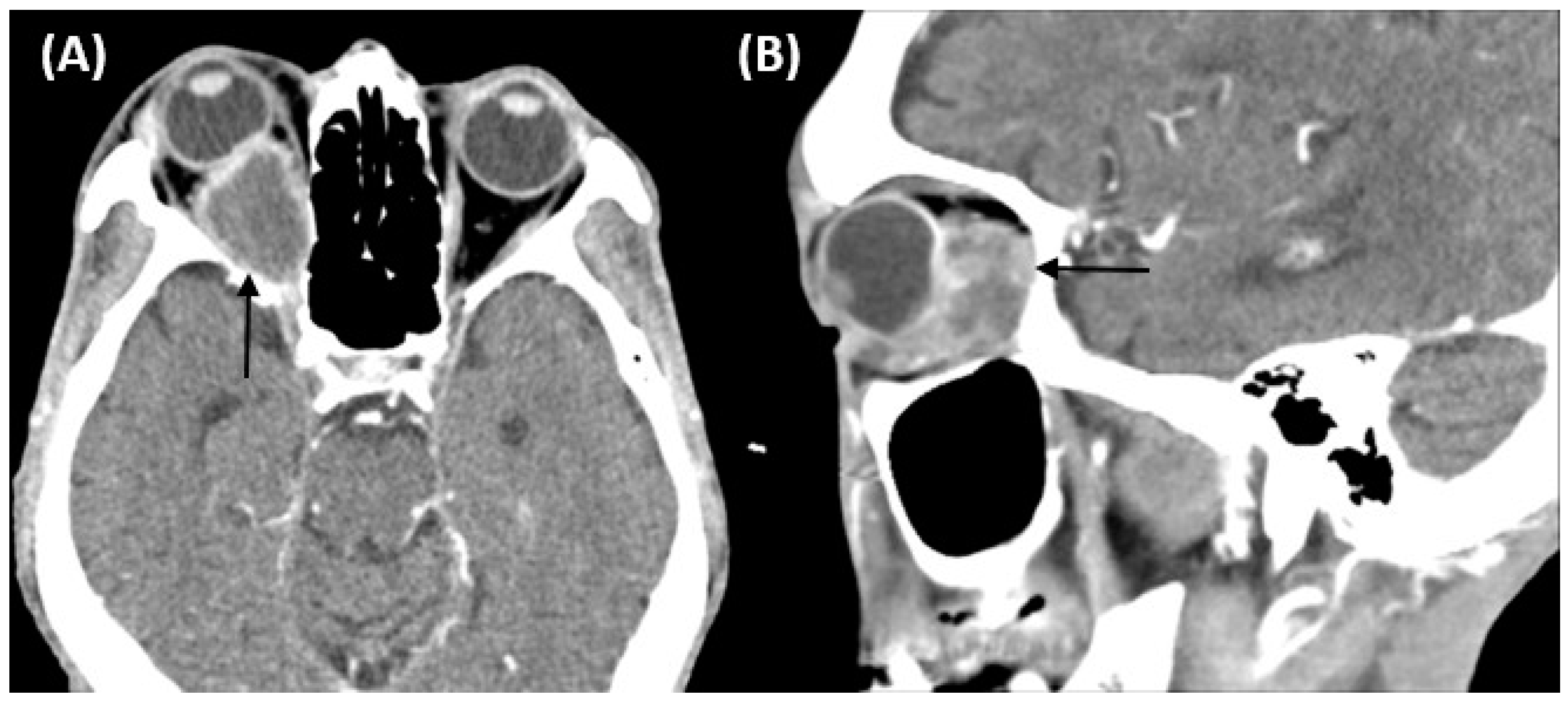 Medicina 57 01238 g002 550