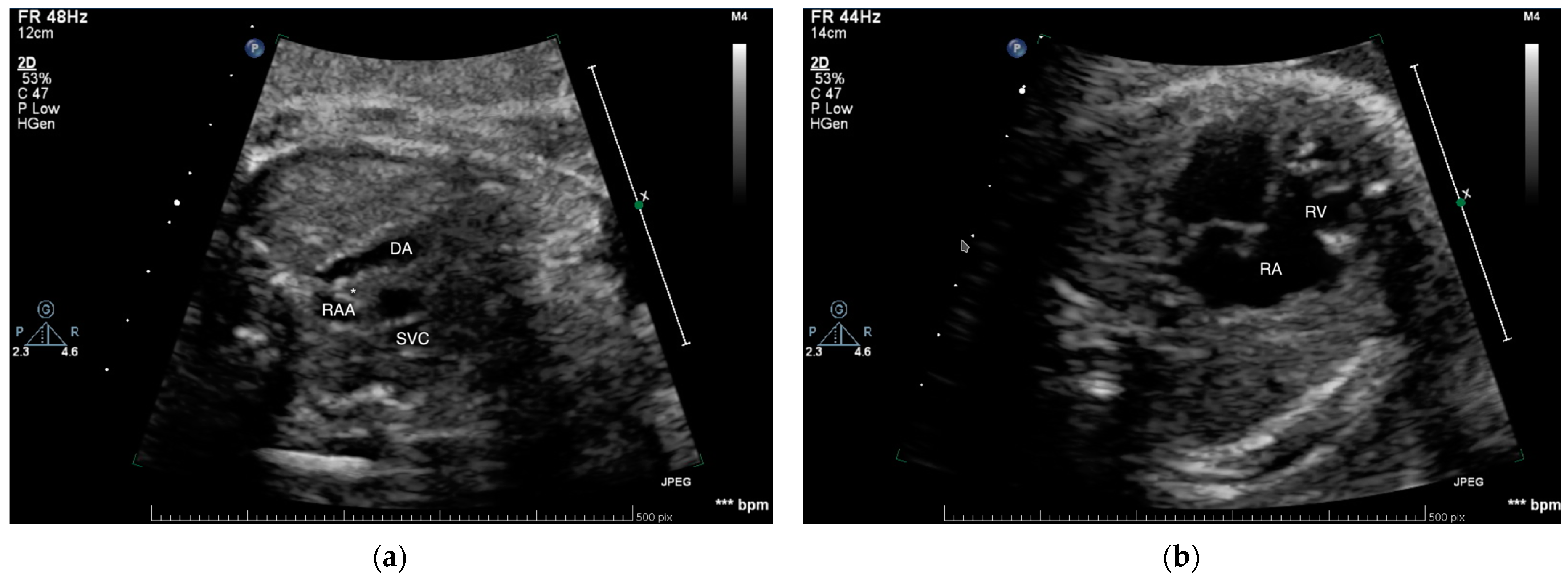 Medicina 57 01239 g001