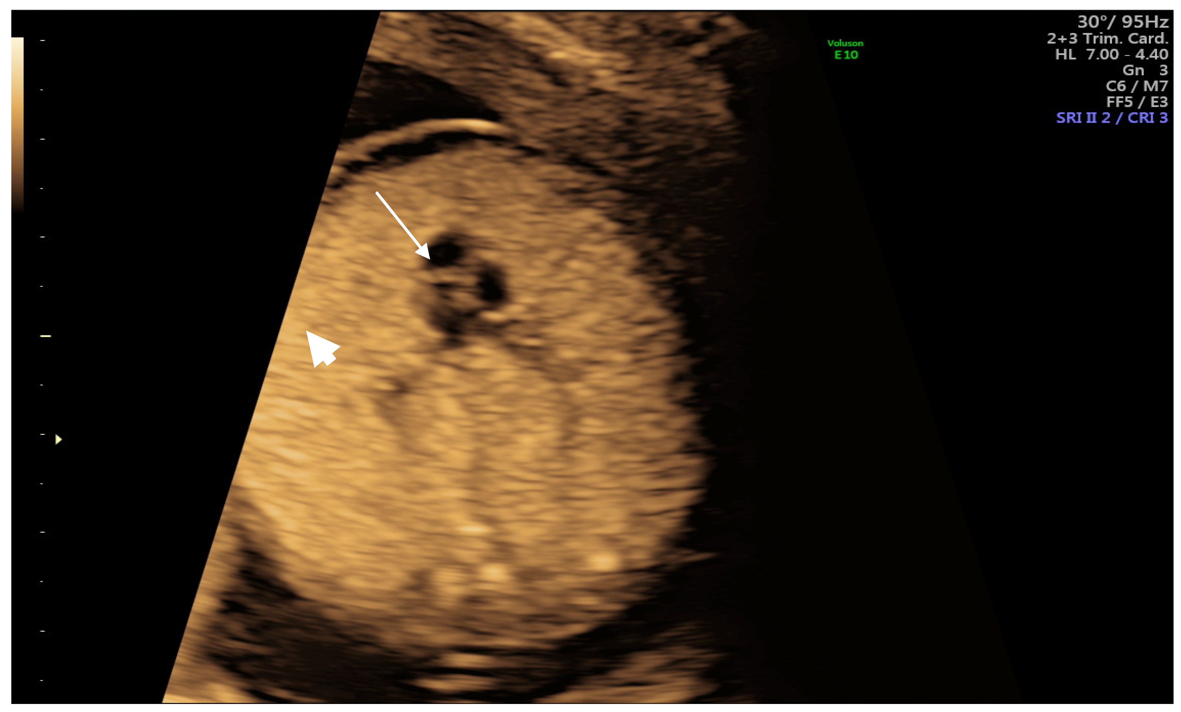 Medicina 57 01253 g001 550