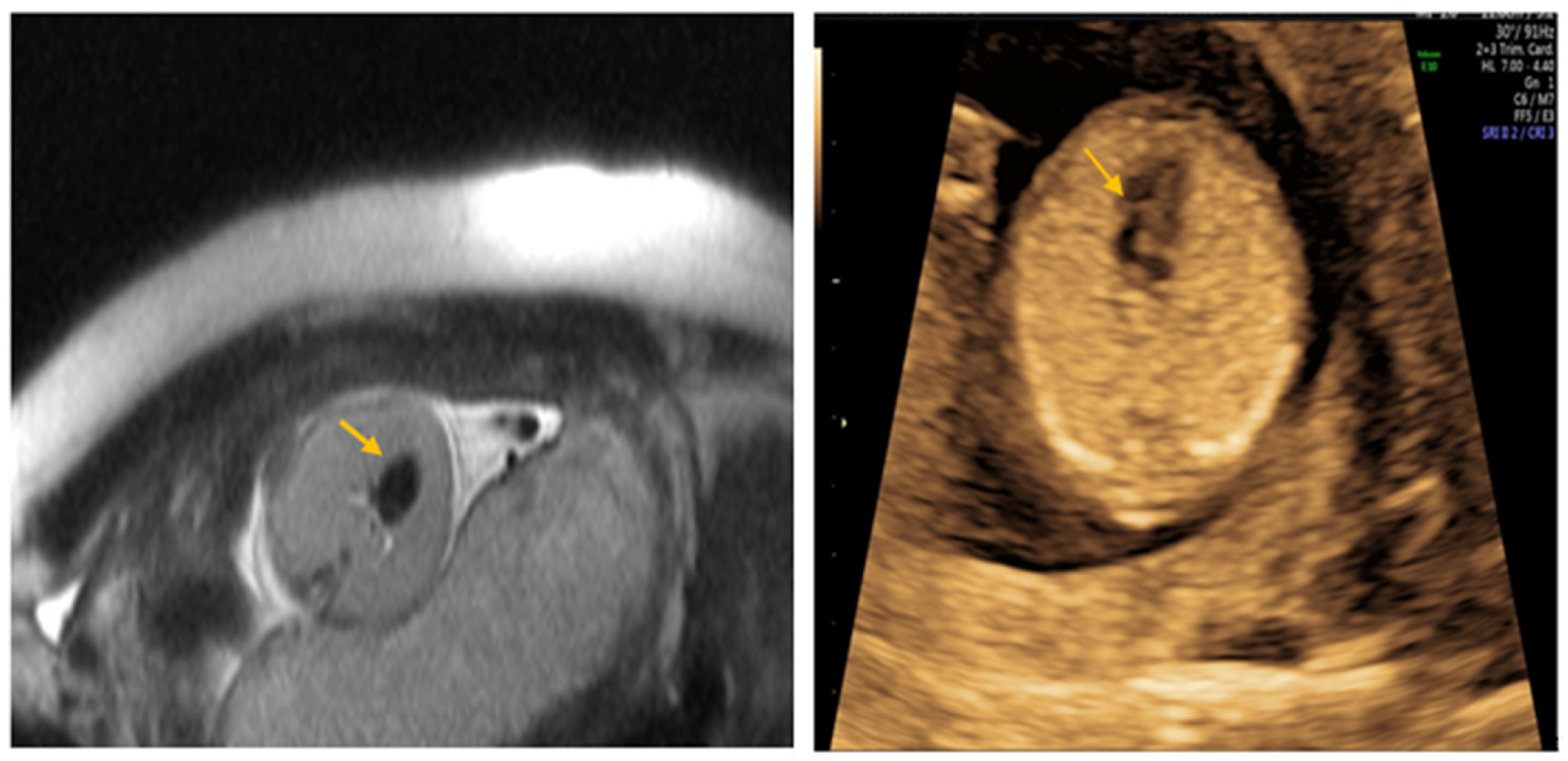 Medicina 57 01253 g002 550