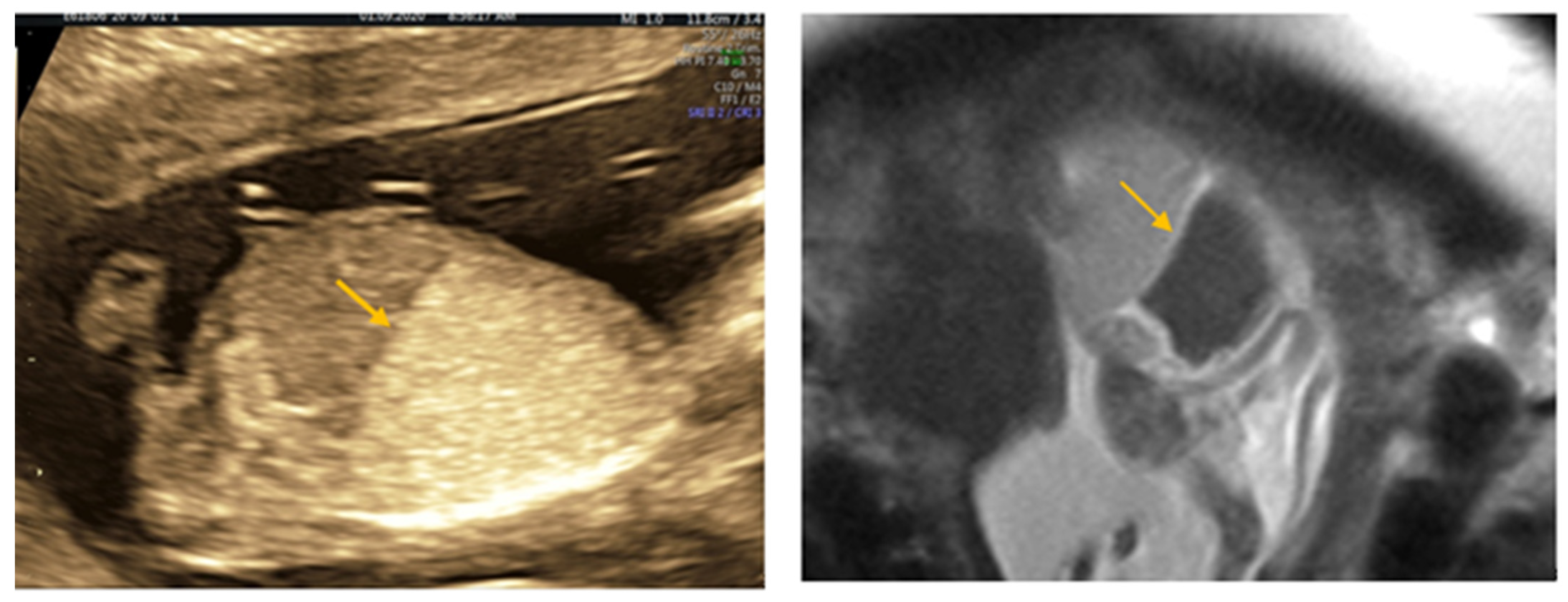 Medicina 57 01253 g003 550