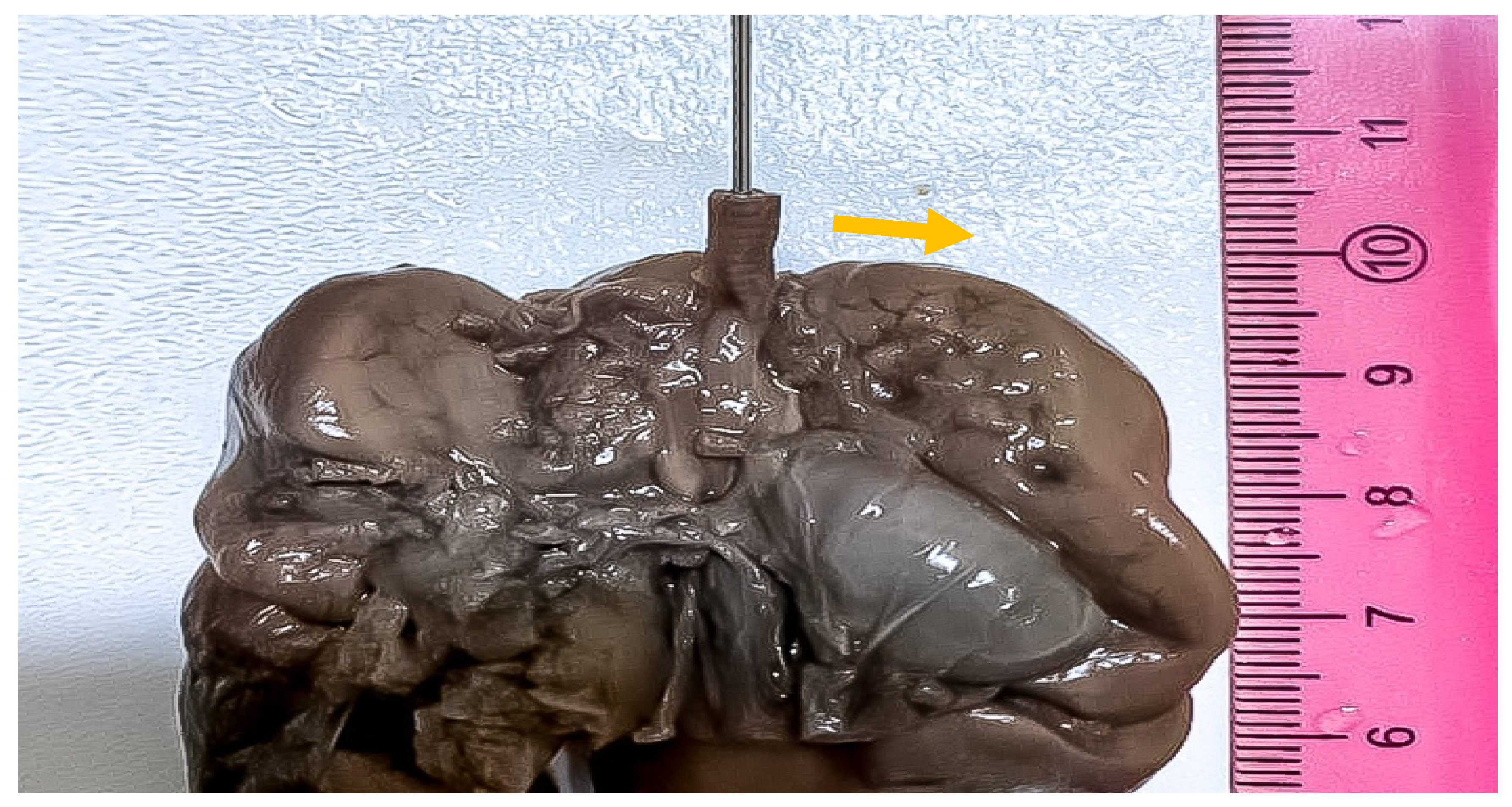 Medicina 57 01253 g005 550