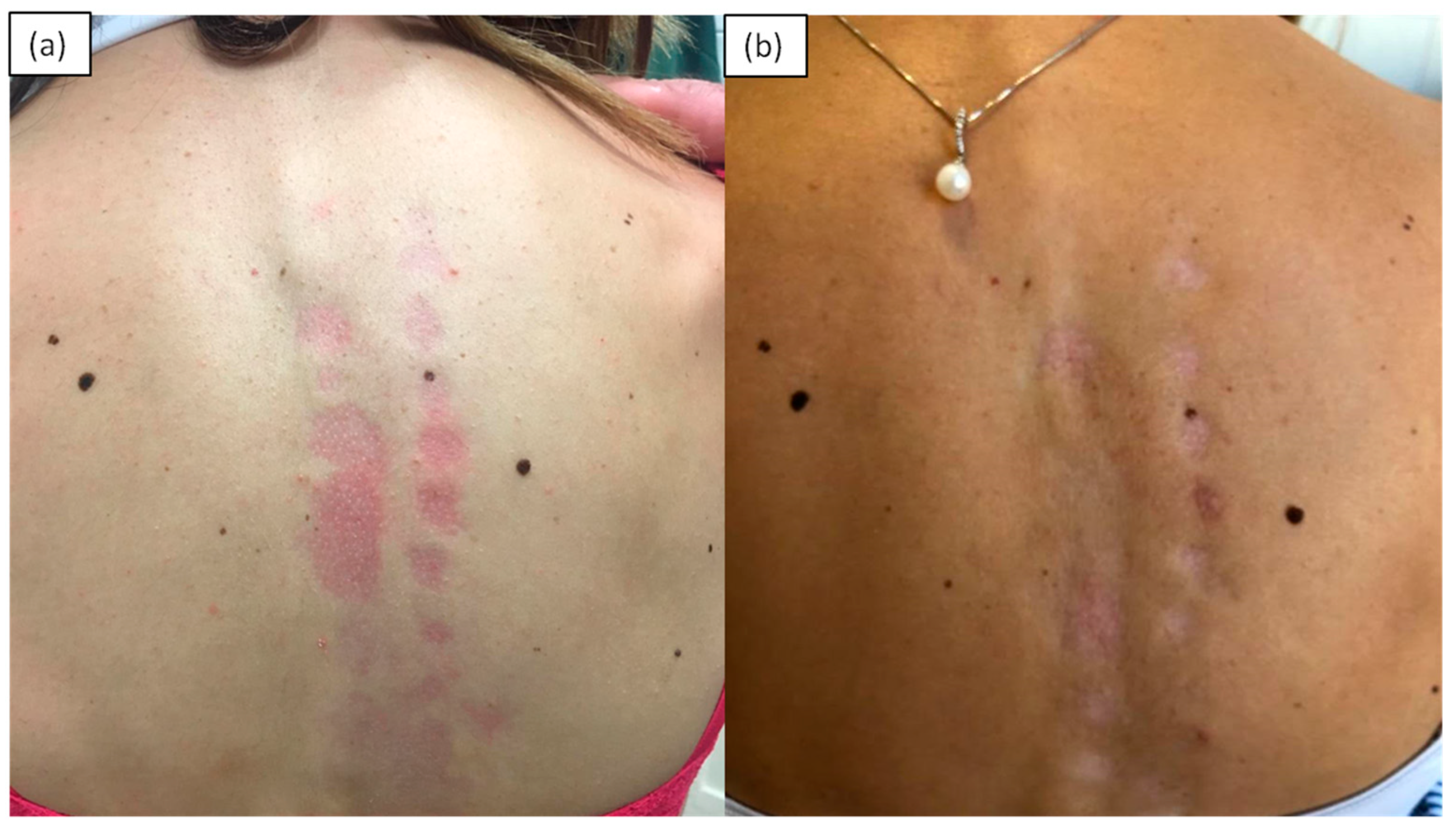 Medicina 57 01275 g002