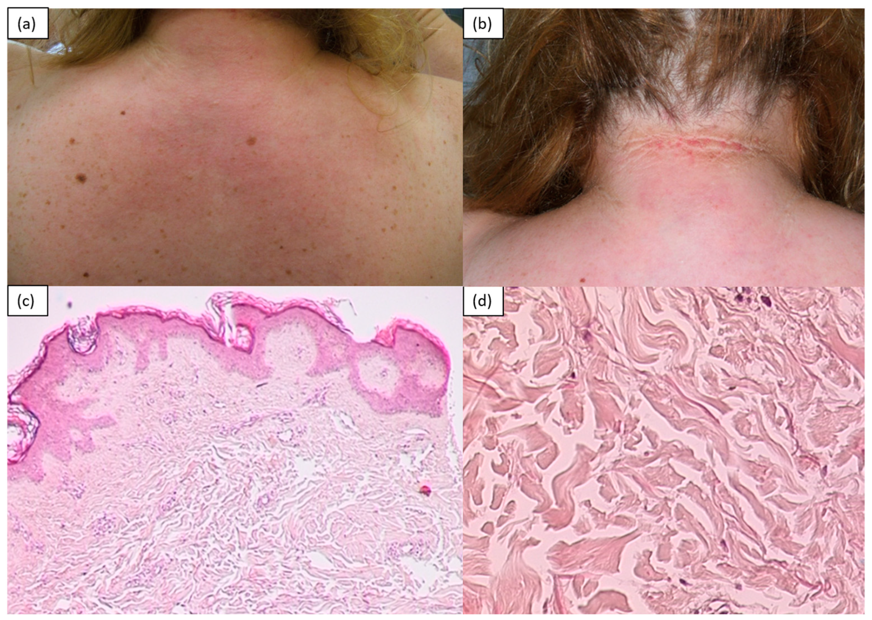 Medicina 57 01275 g005