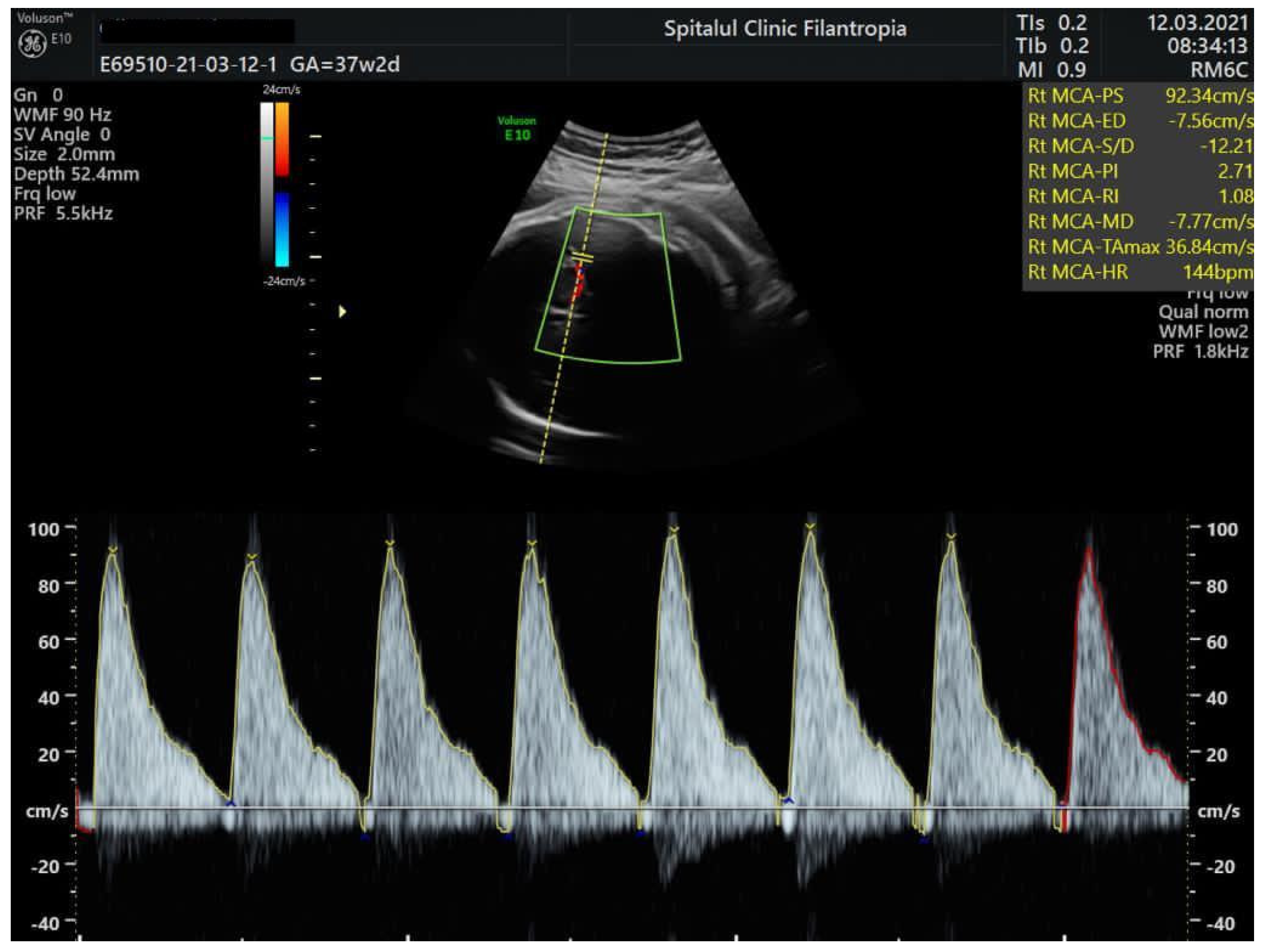 Fetology: Diagnosis and Management of the Fetal Patient