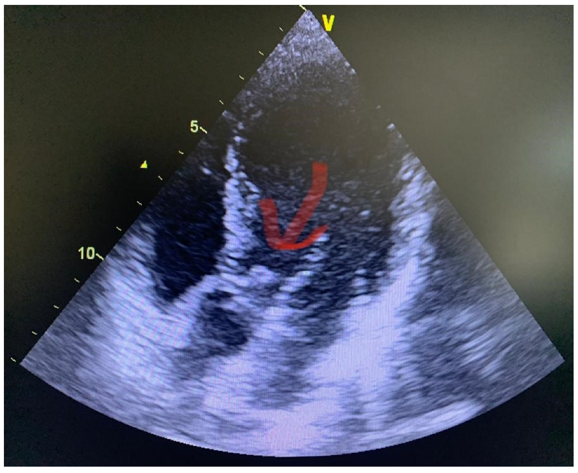 Medicina 57 01298 g0a1 550