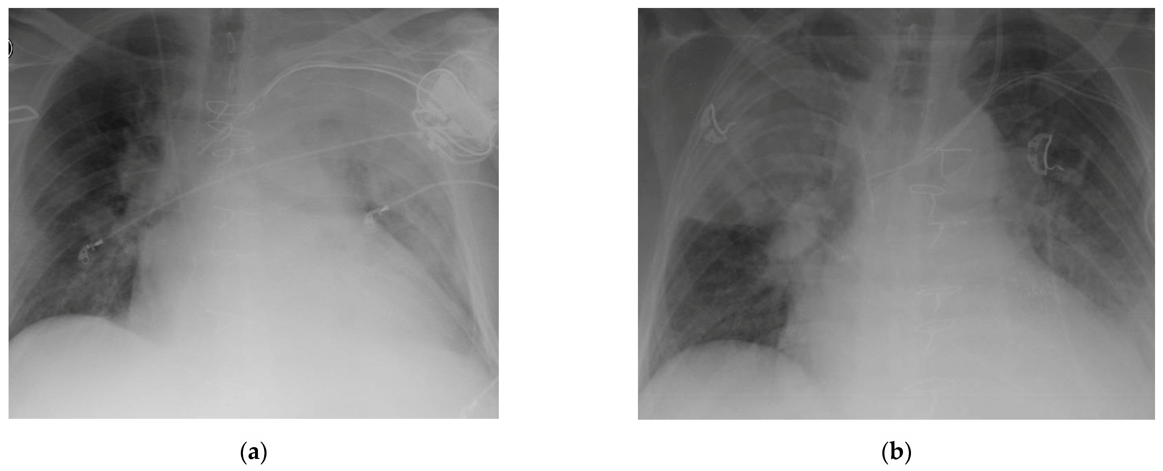 Medicina 57 01300 g003 550