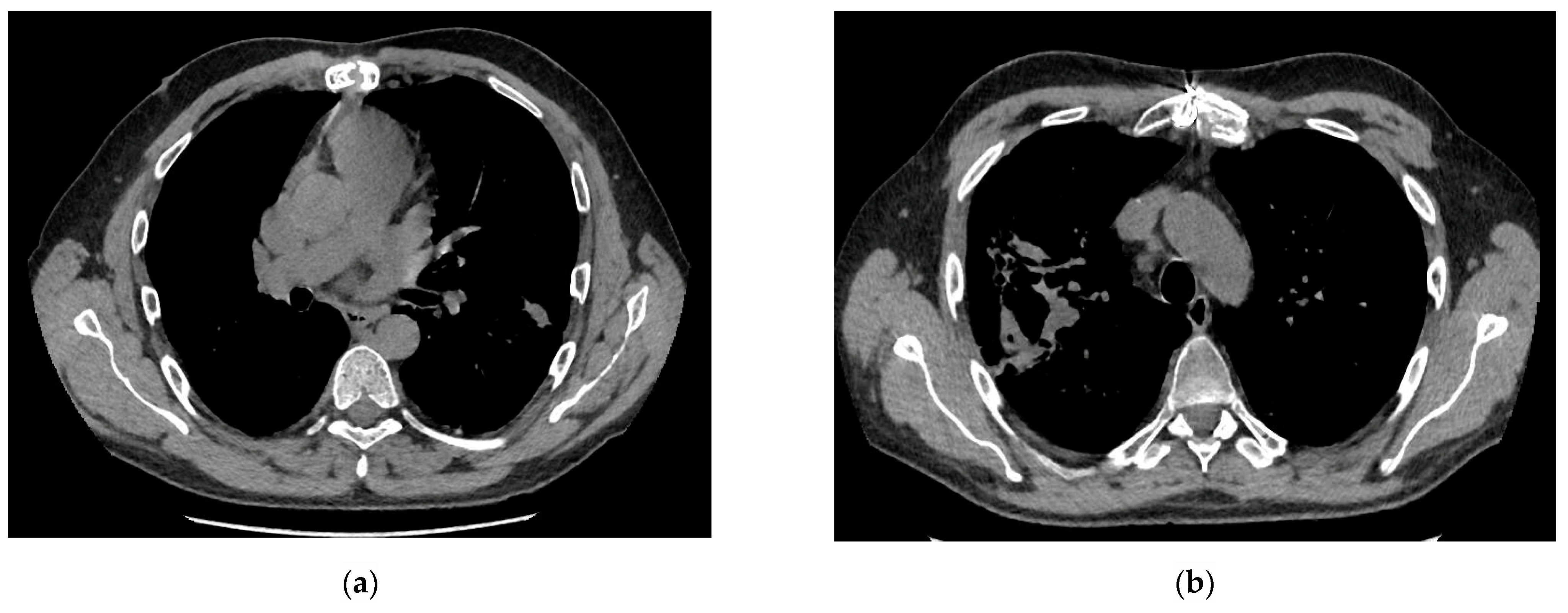 Medicina 57 01300 g004 550