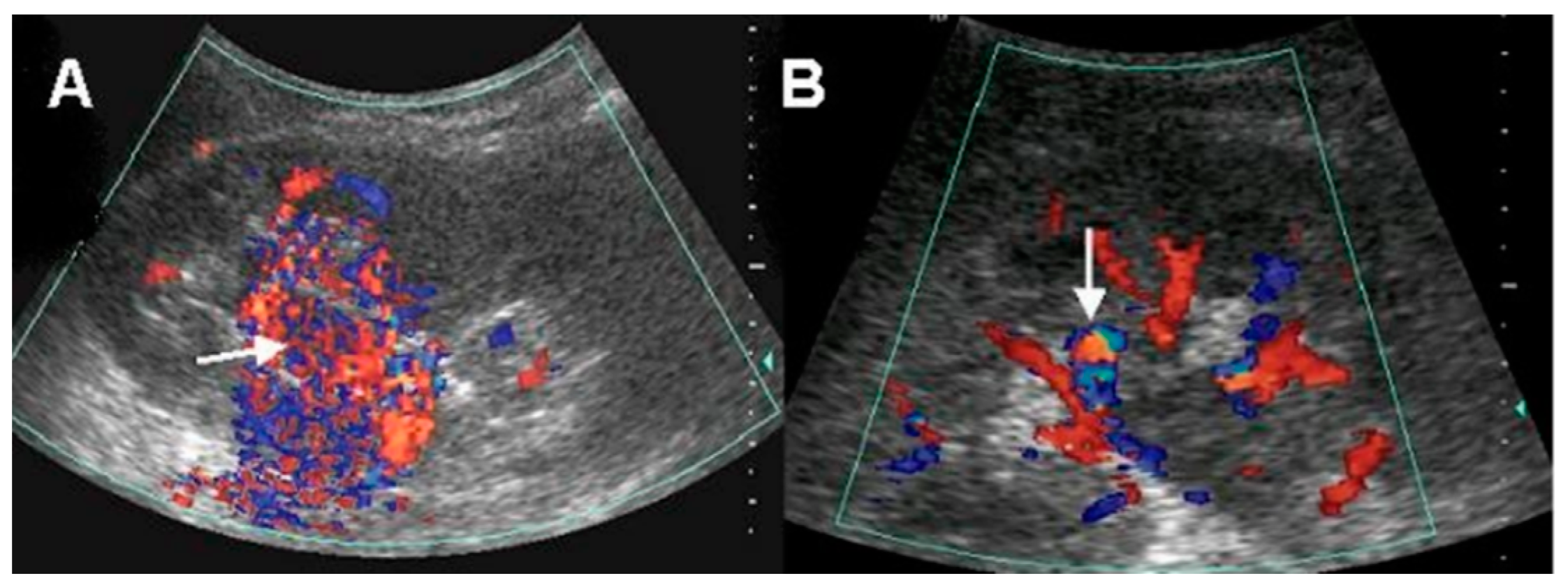 Medicina 57 01304 g001 550