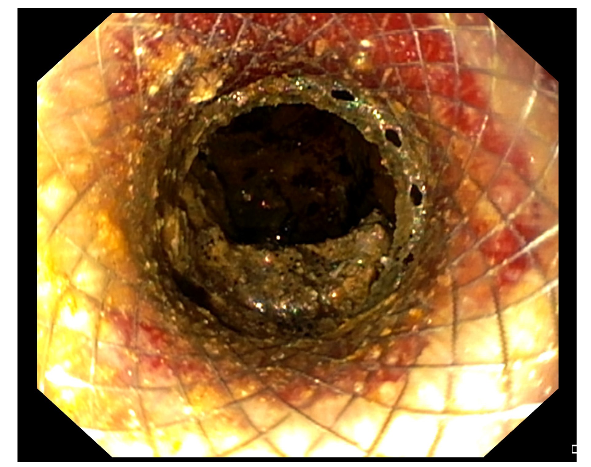 Medicina 57 01305 g002 Medicina 57 01305 g002