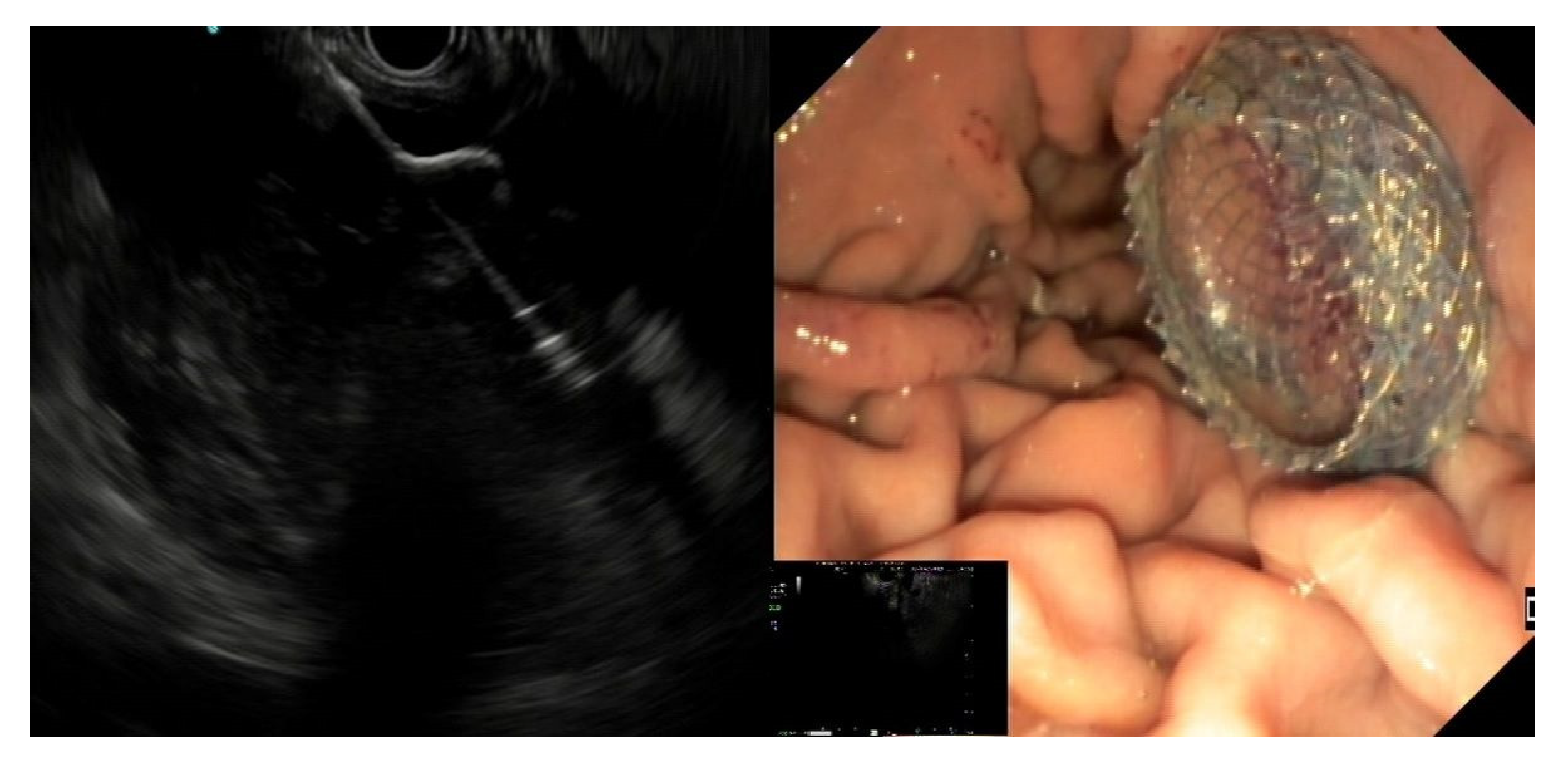 Medicina 57 01305 g003 Medicina 57 01305 g003