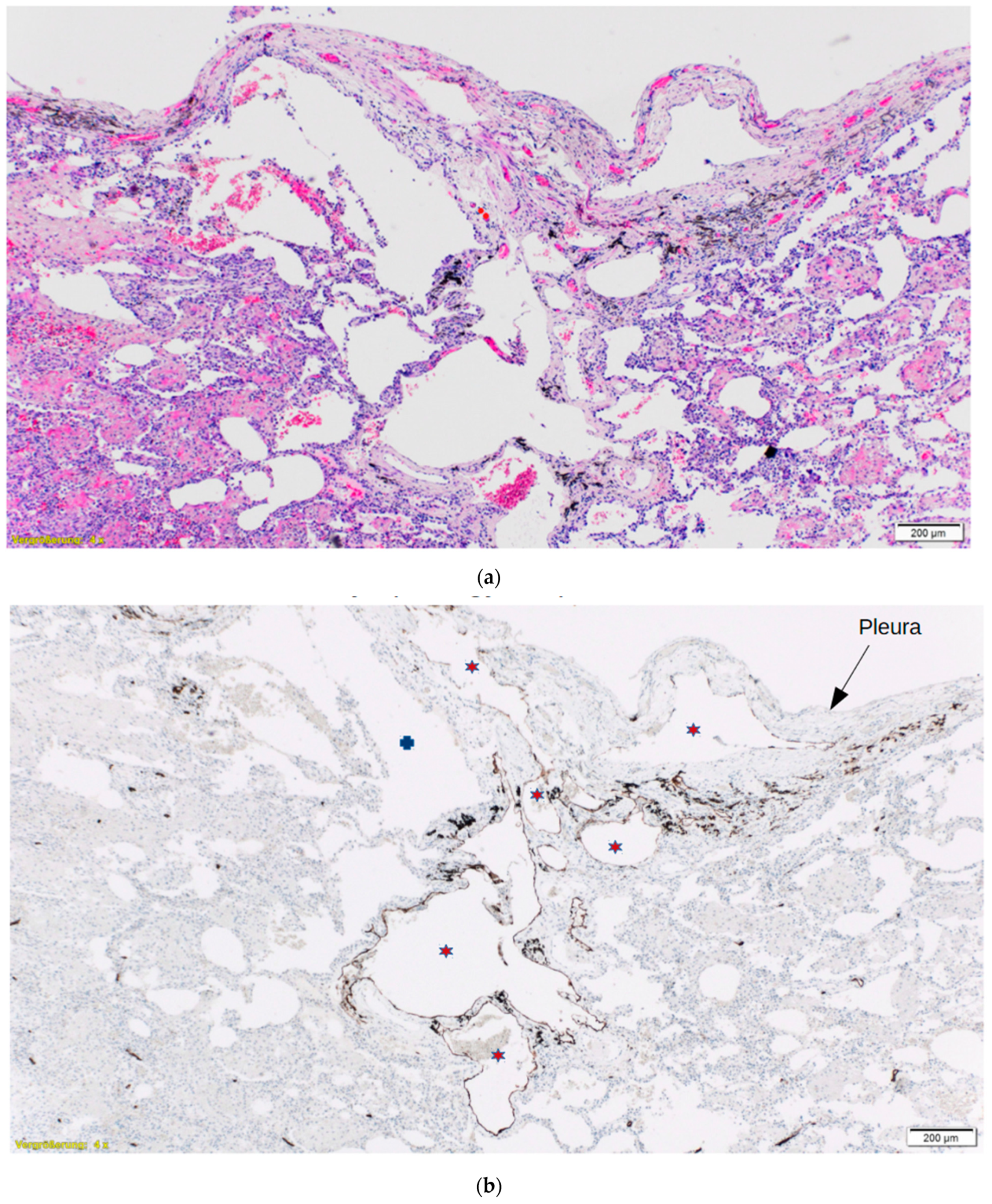 Medicina 57 01308 g003
