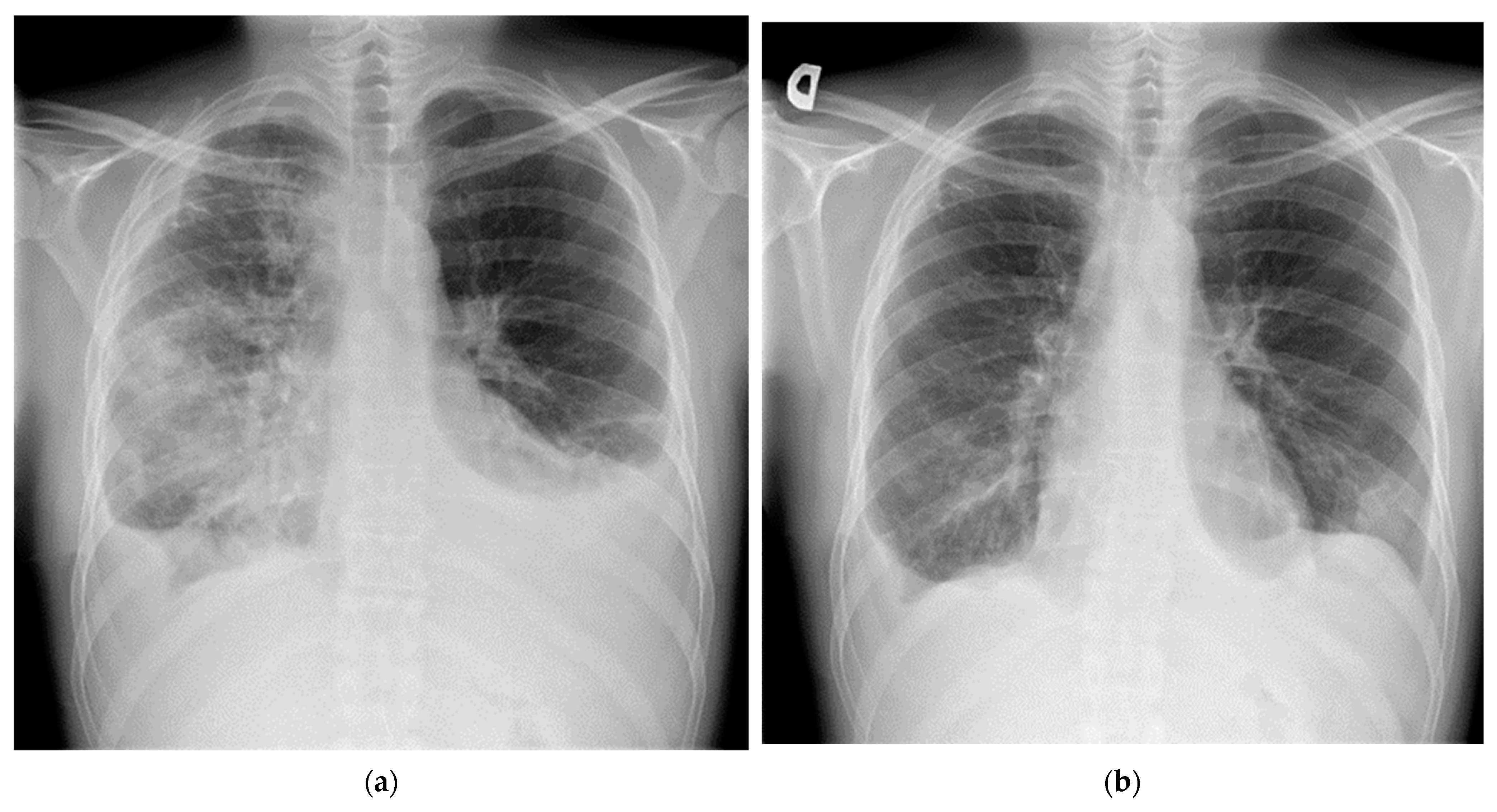 Medicina 57 01308 g004