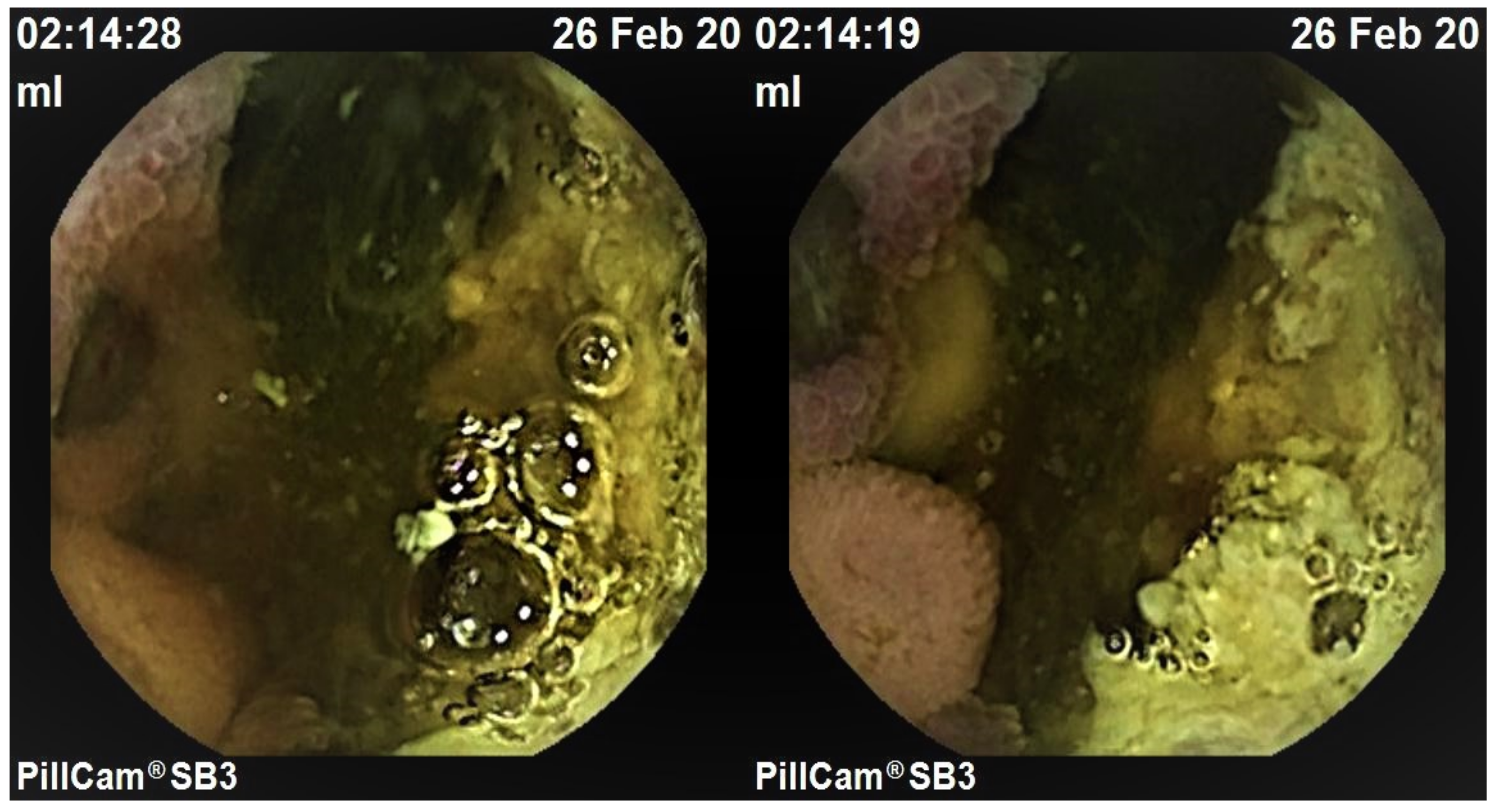 Medicina 57 01313 g001 Medicina 57 01313 g001