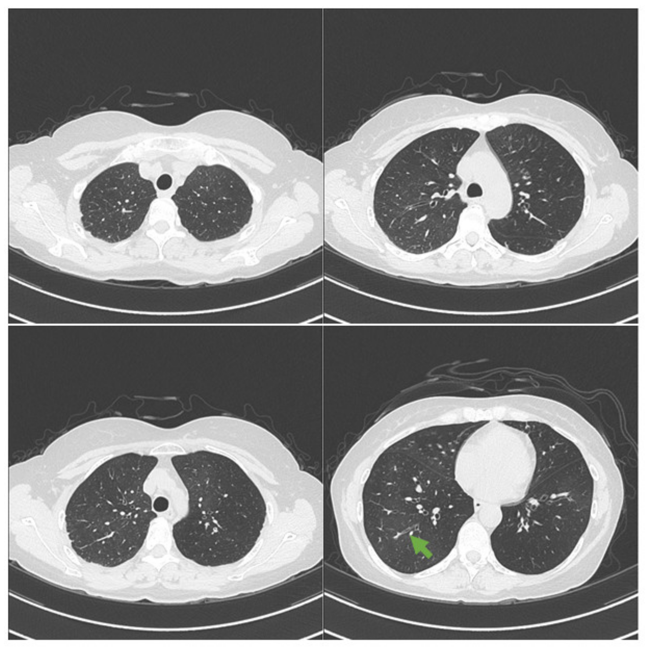Medicina 57 01315 g001 550