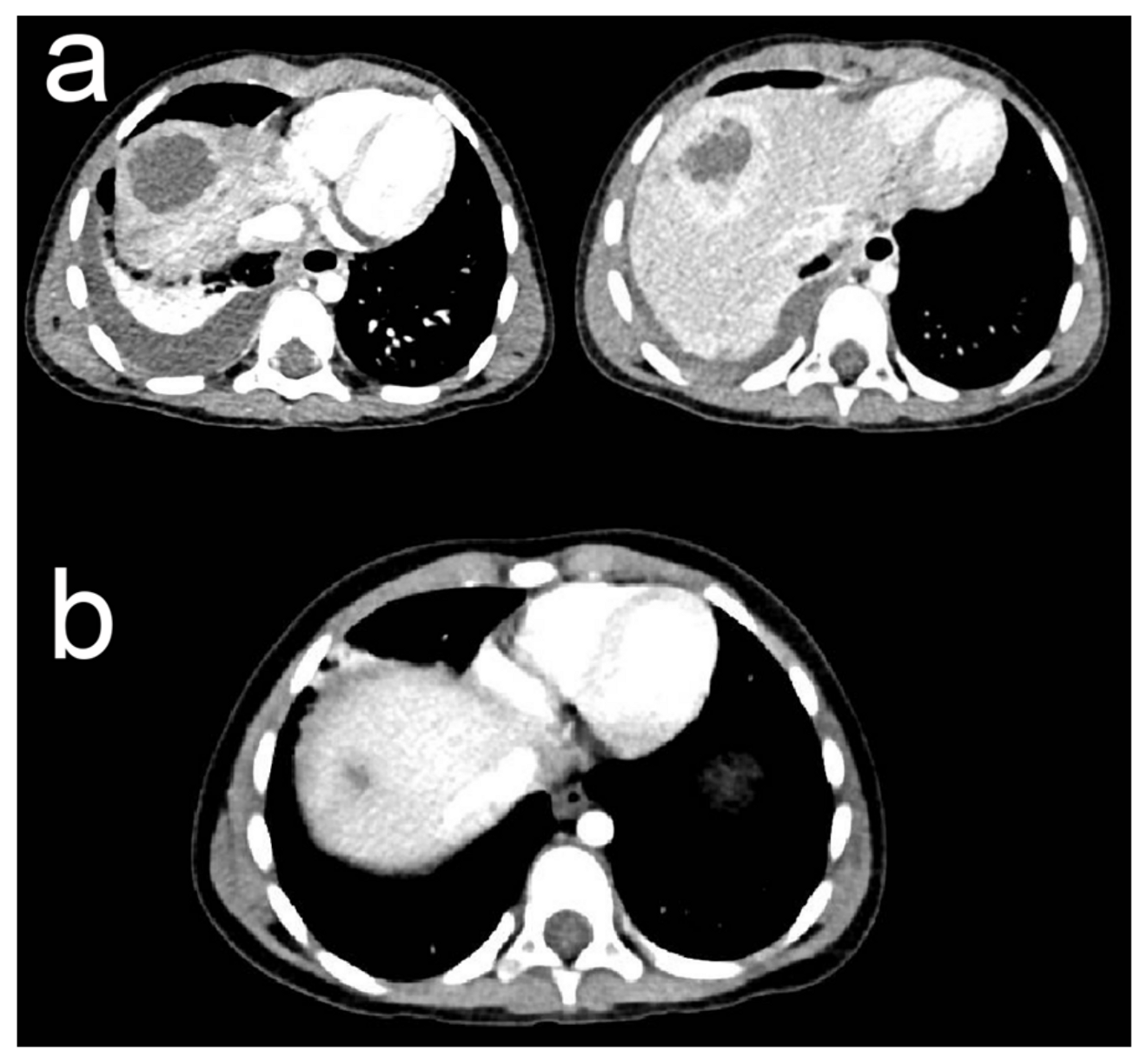 Medicina 57 01322 g002