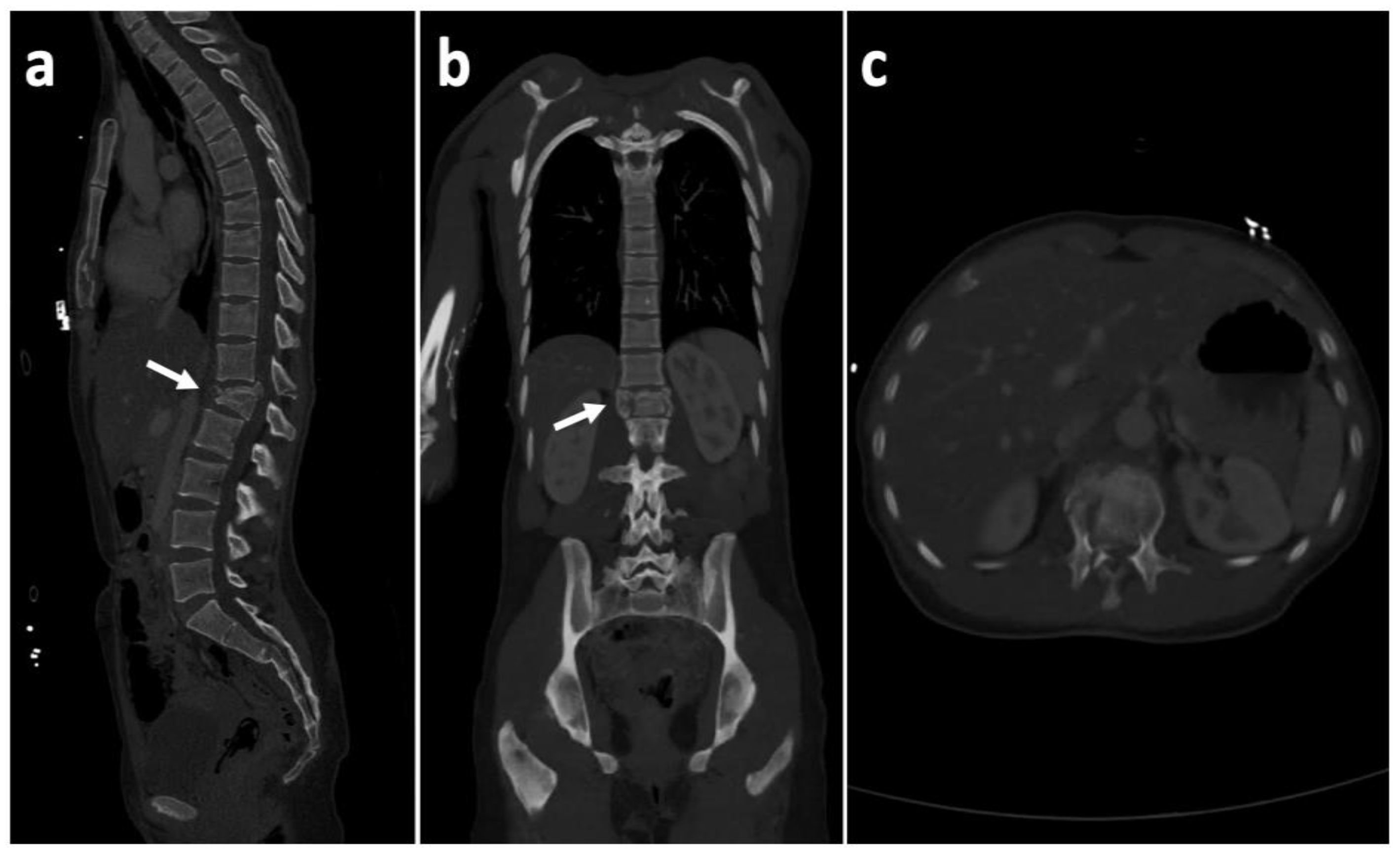 Medicina 57 01328 g001 550
