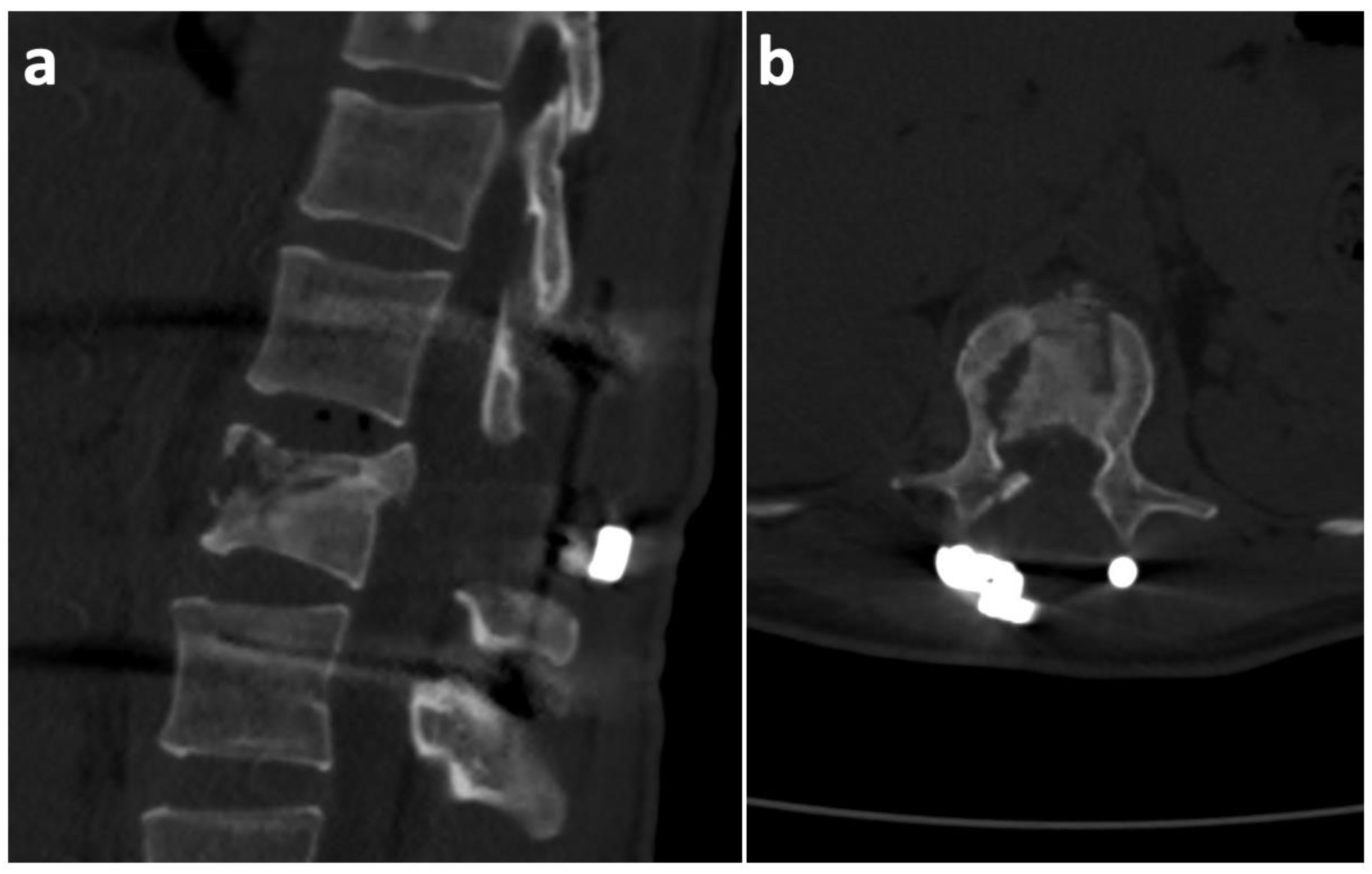 Medicina 57 01328 g003 550